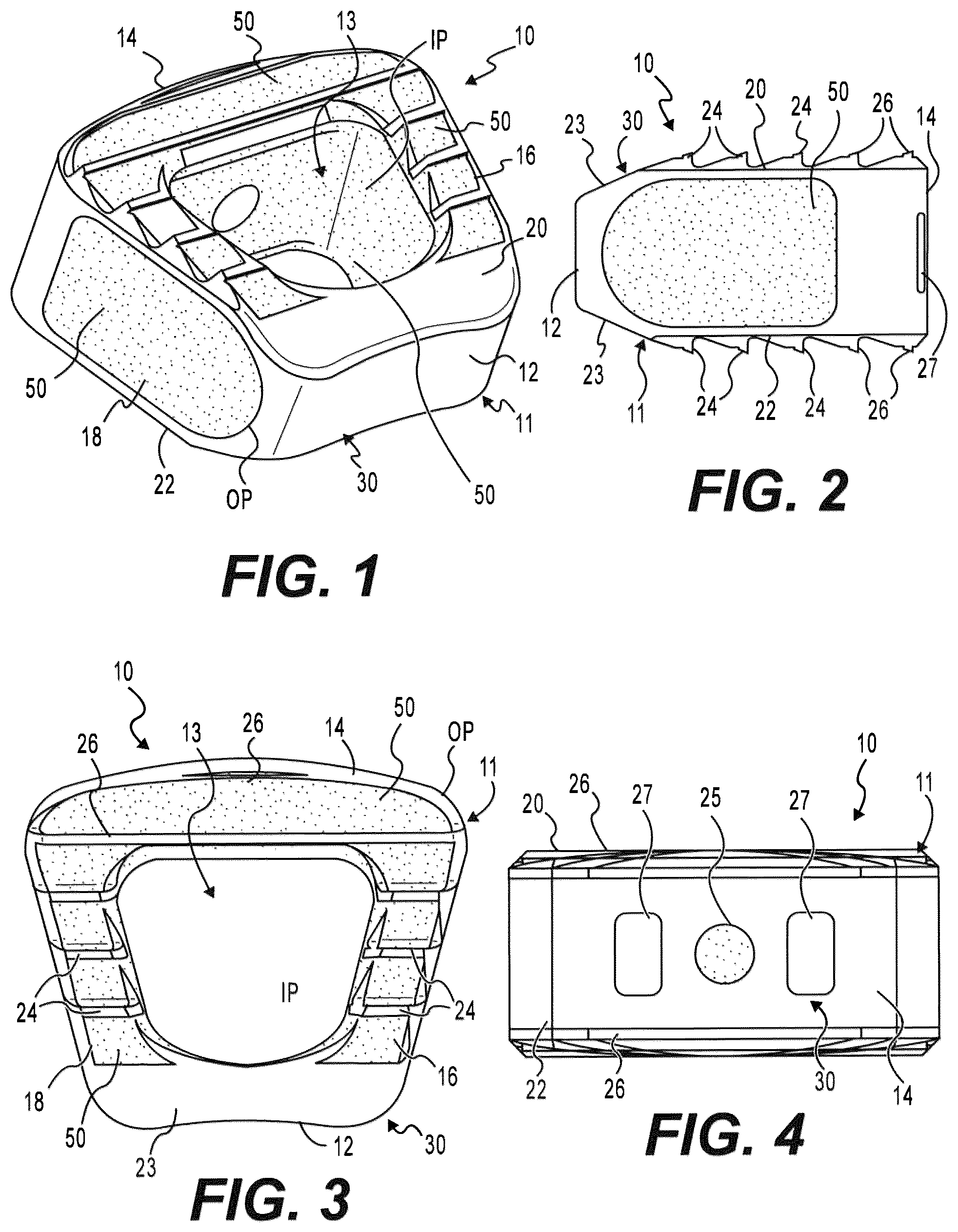 Patent US12310859 Figure 1 – Intervertebral spinal implant