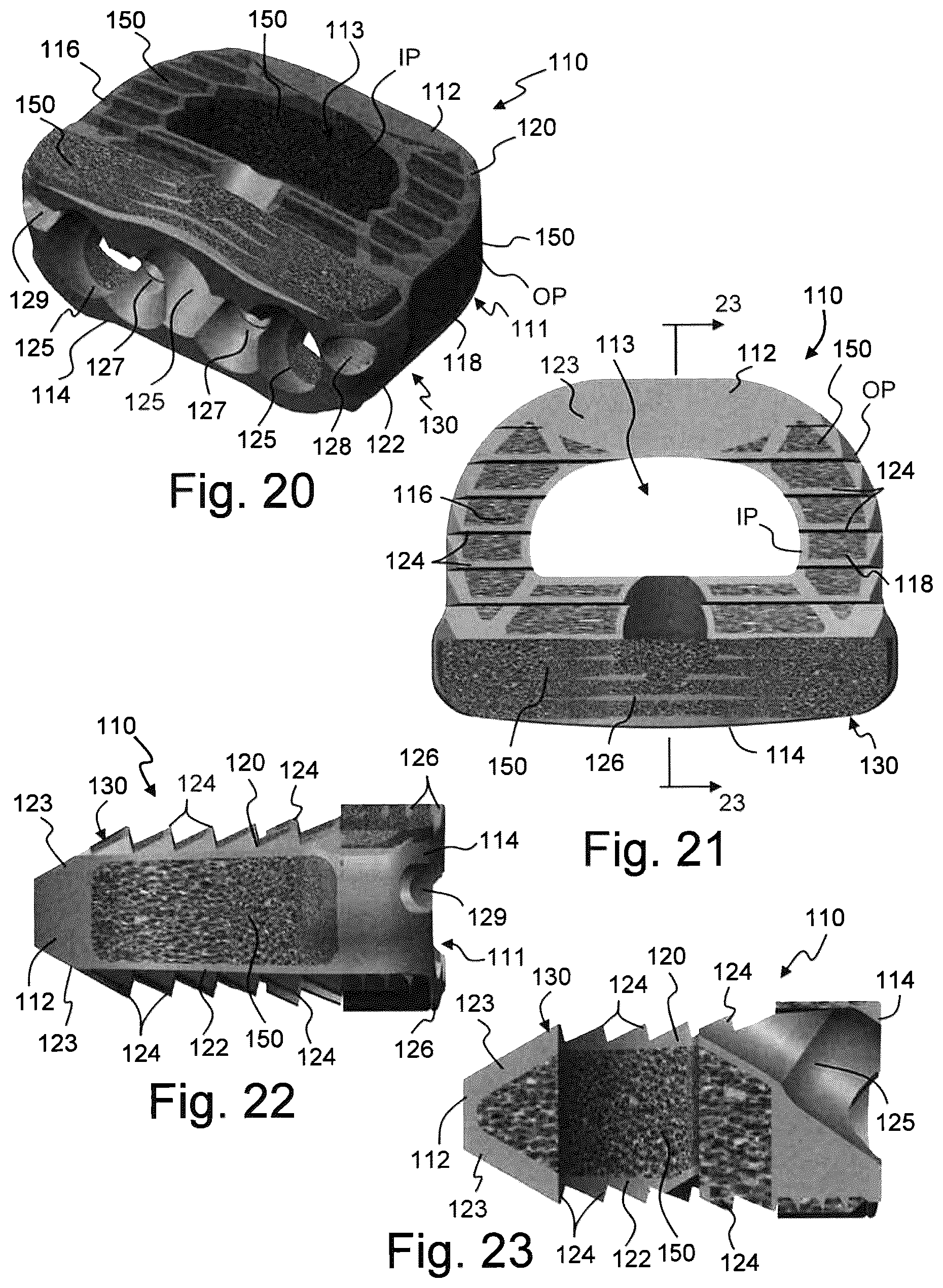 Patent US12310859 Figure 7 – Intervertebral spinal implant