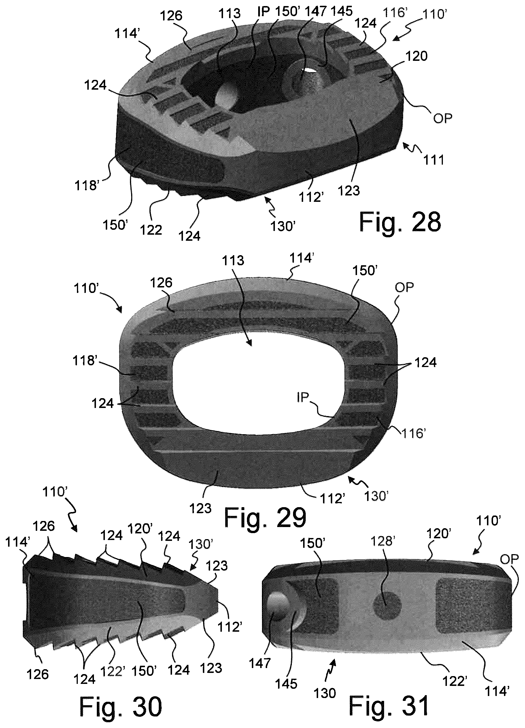 Patent US12310859 Figure 9 – Intervertebral spinal implant