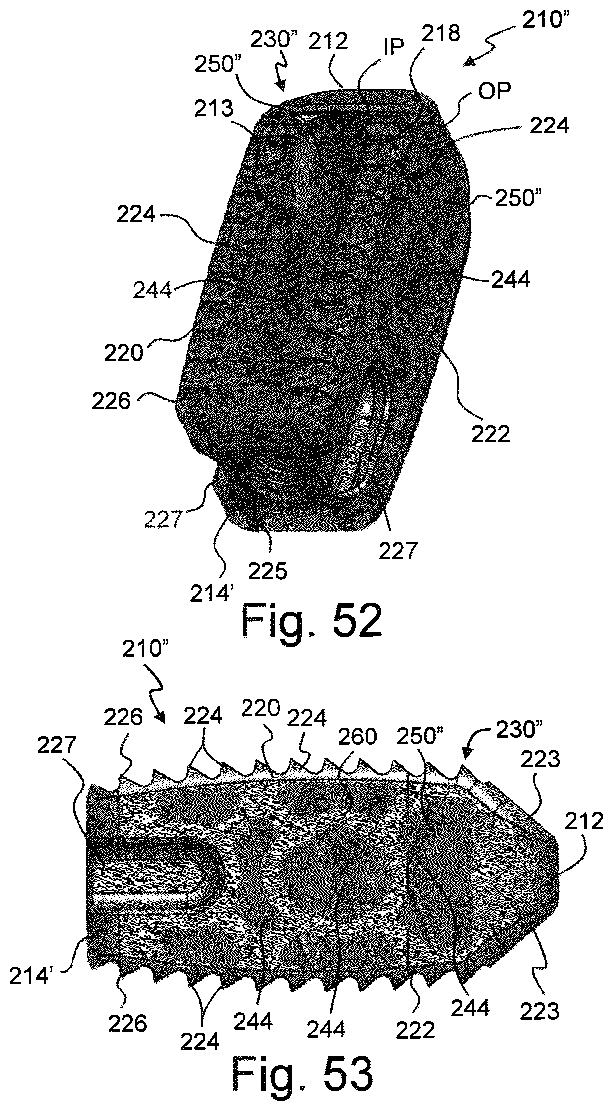Patent US12310859 Figure 16 – Intervertebral spinal implant