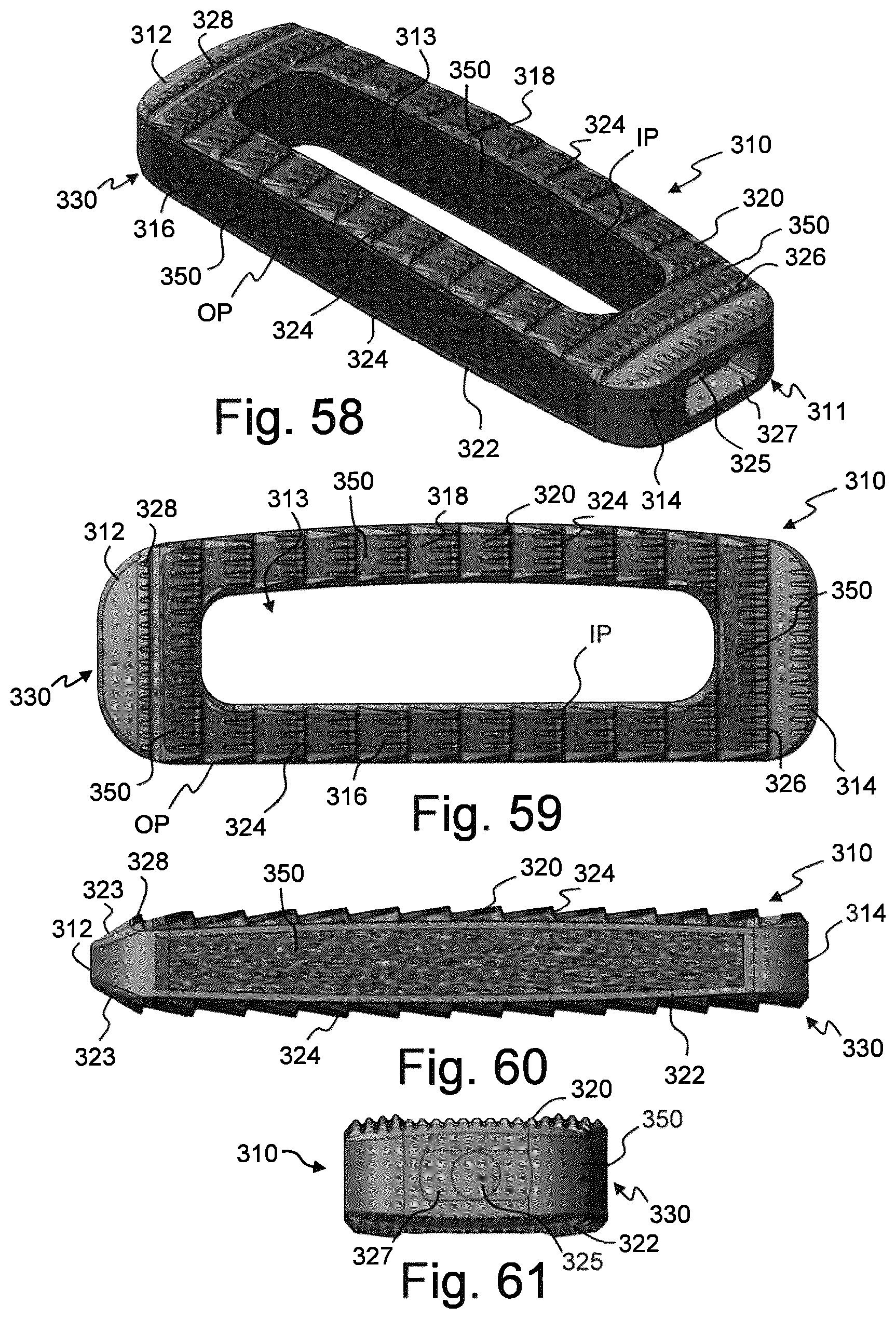 Patent US12310859 Figure 18 – Intervertebral spinal implant