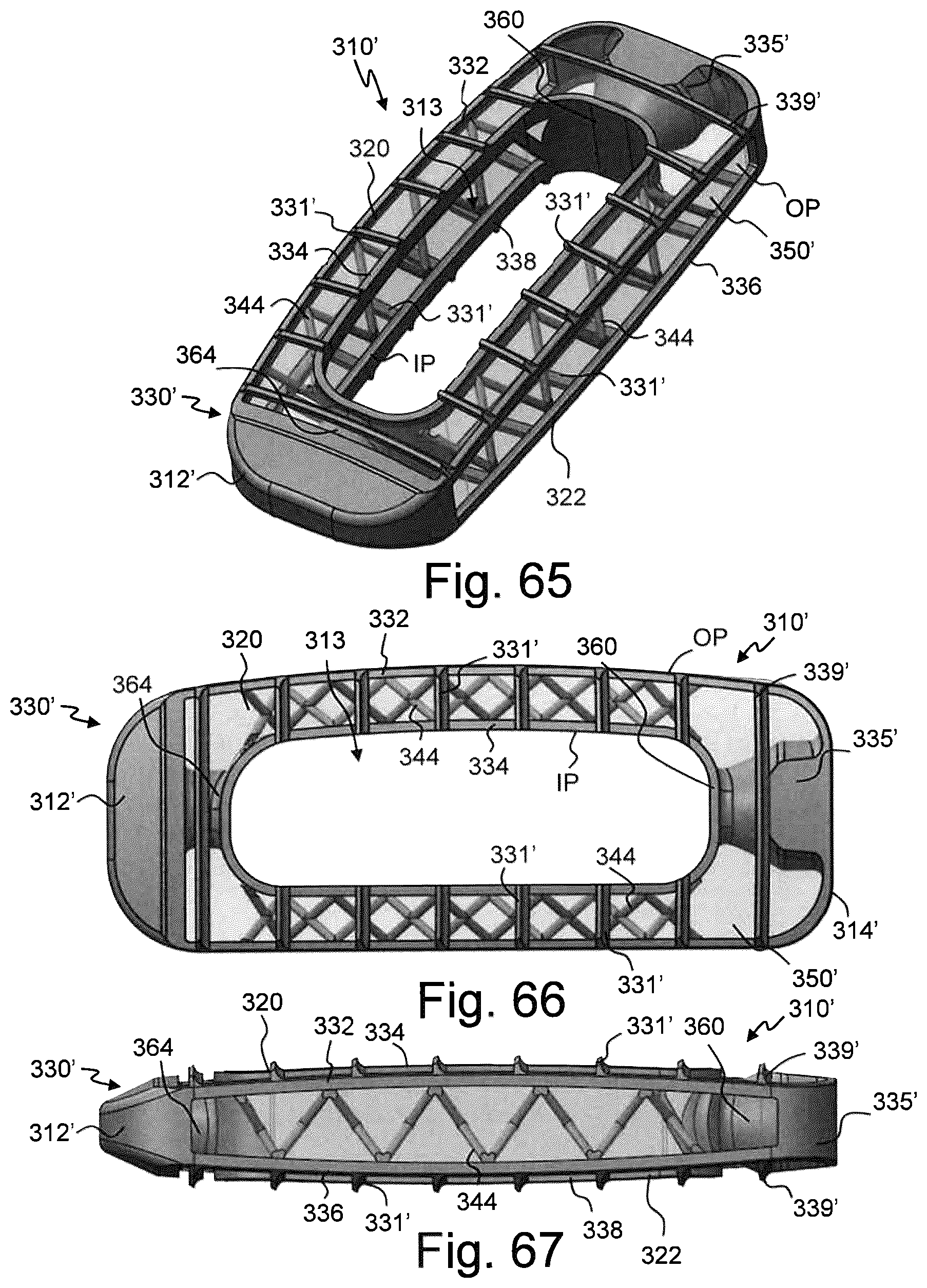 Patent US12310859 Figure 20 – Intervertebral spinal implant