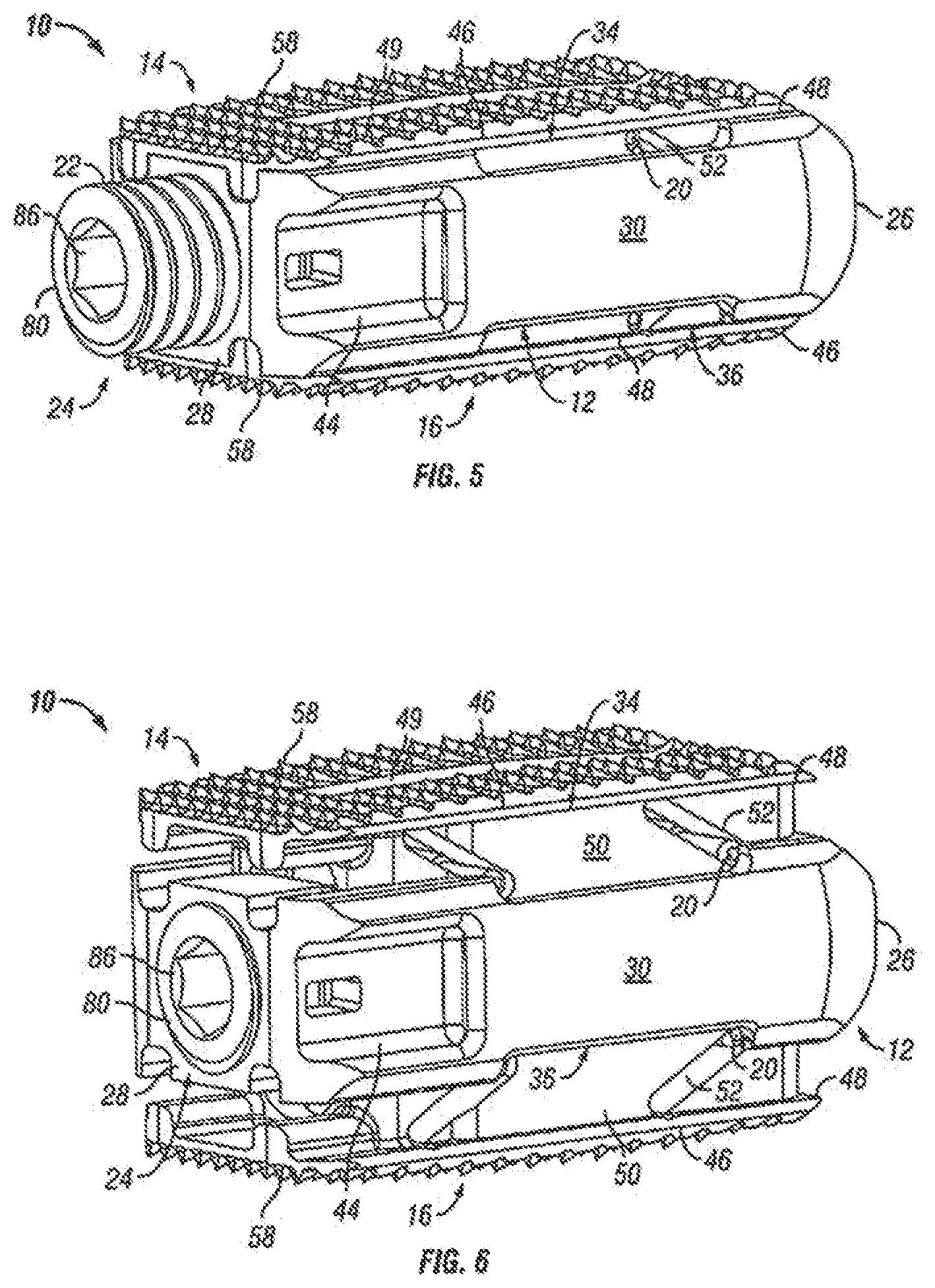 Patent US12310860 Figure 4 – Expandable fusion device and method of installation thereof