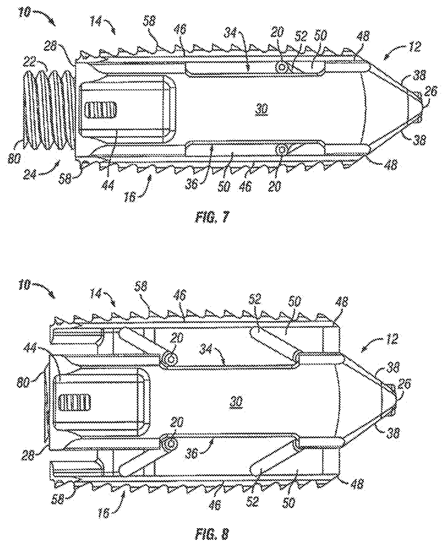 Patent US12310860 Figure 5 – Expandable fusion device and method of installation thereof