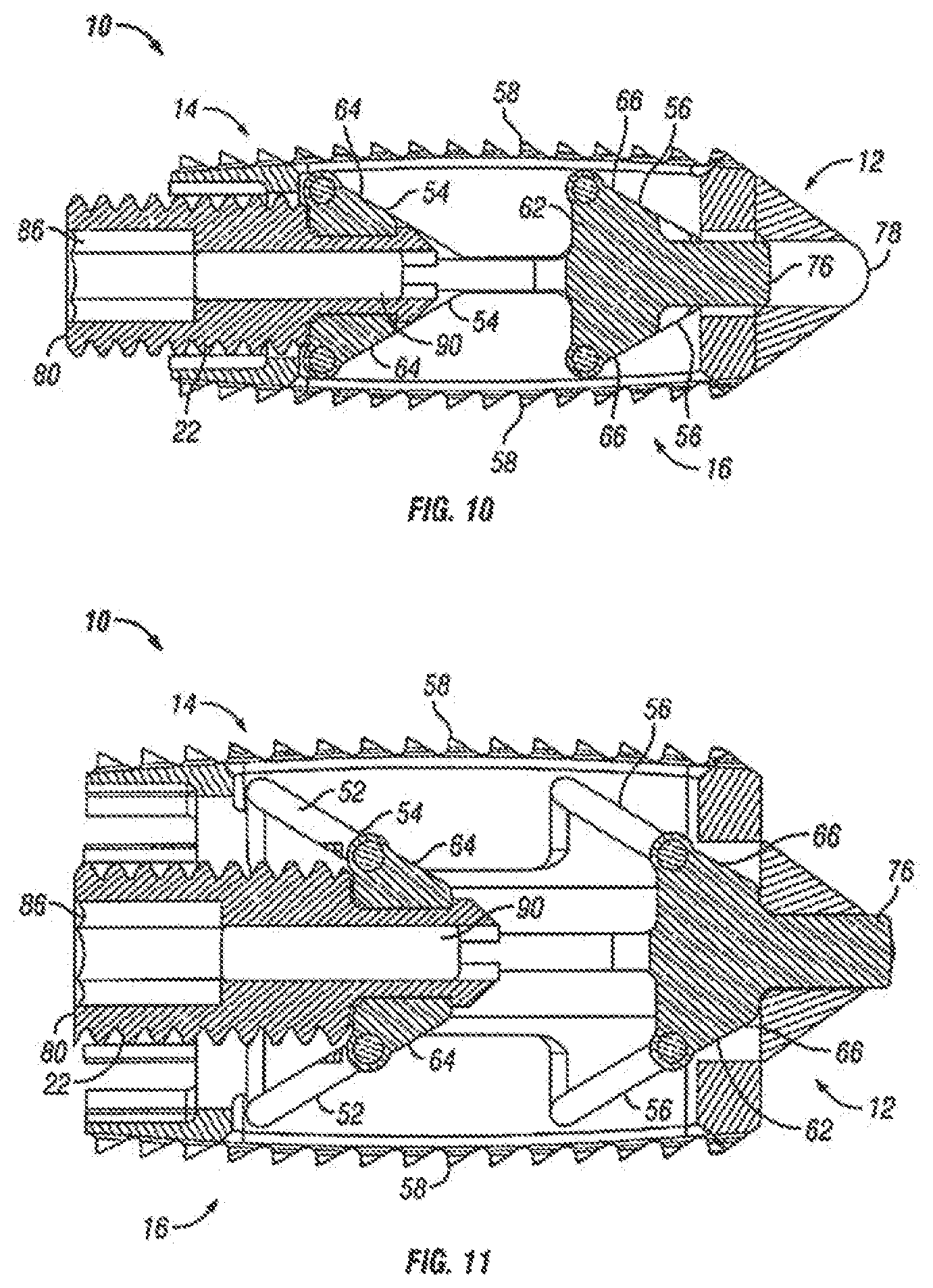 Patent US12310860 Figure 7 – Expandable fusion device and method of installation thereof