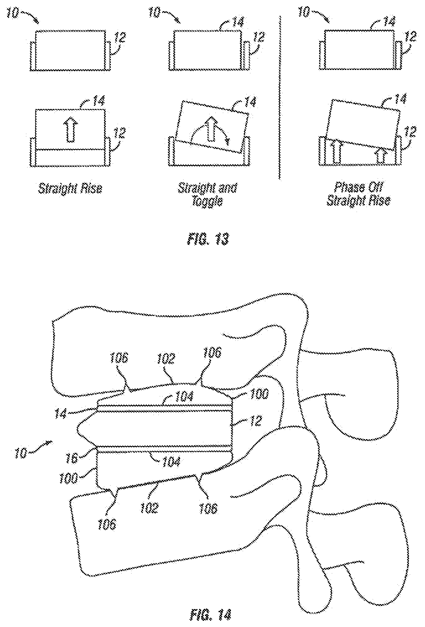 Patent US12310860 Figure 8 – Expandable fusion device and method of installation thereof