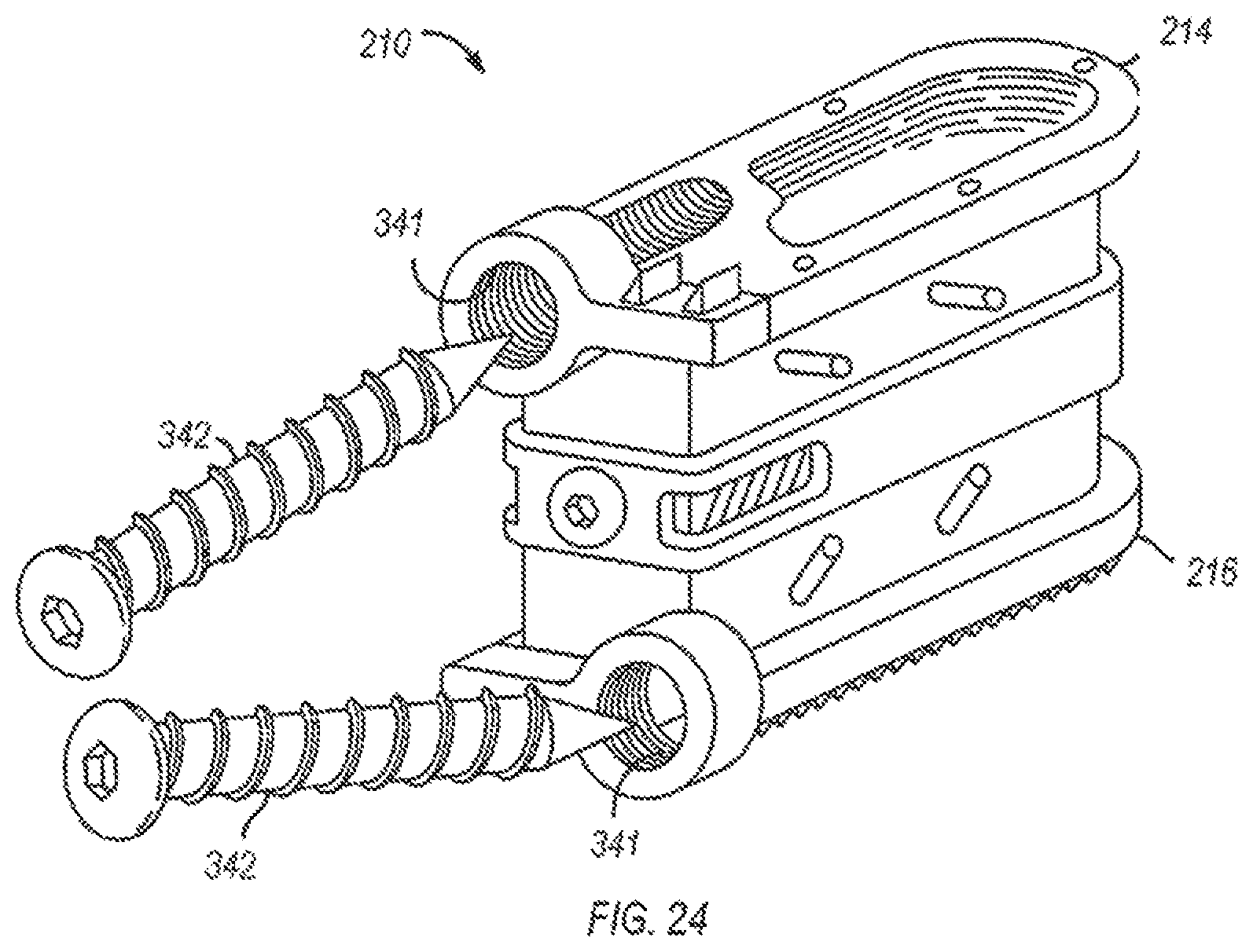 Patent US12310860 Figure 15 – Expandable fusion device and method of installation thereof