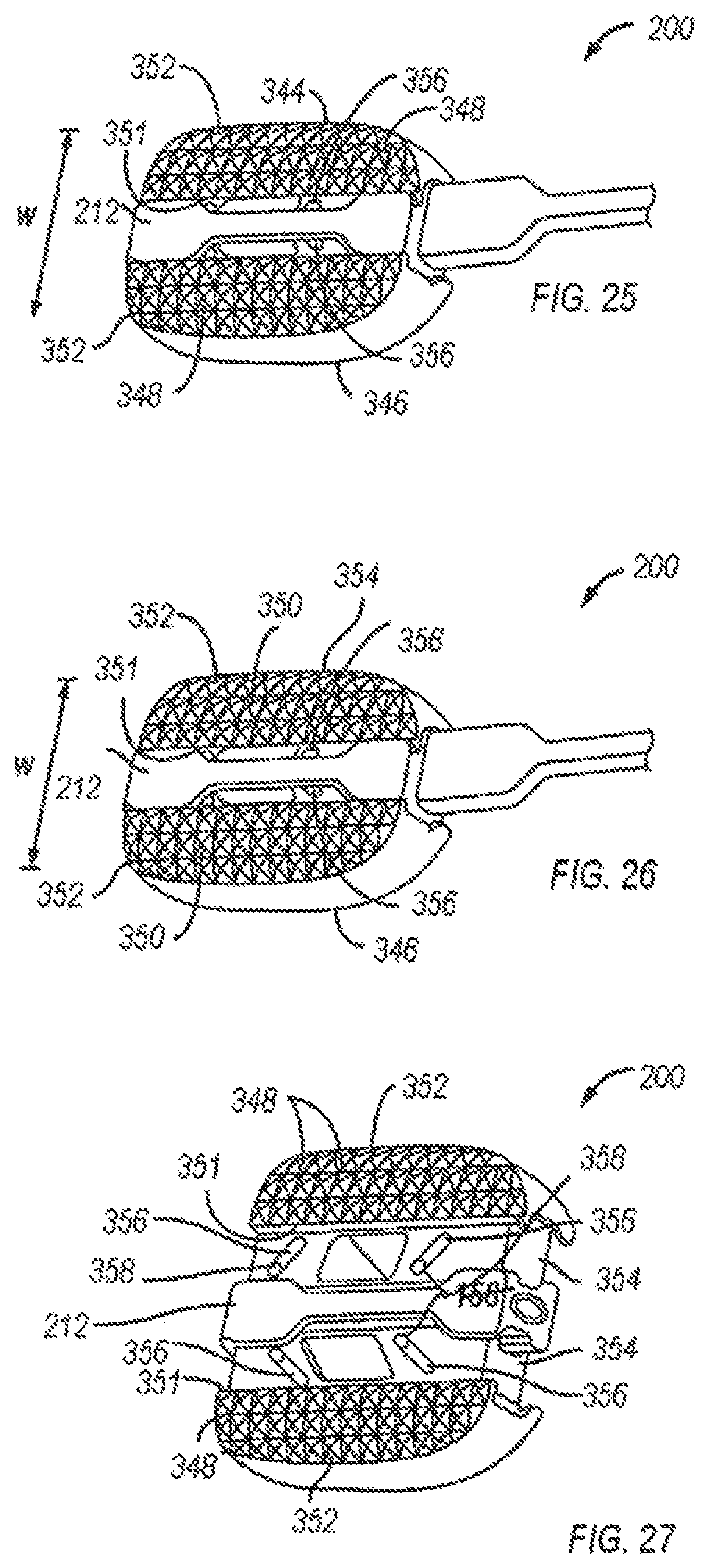 Patent US12310860 Figure 16 – Expandable fusion device and method of installation thereof