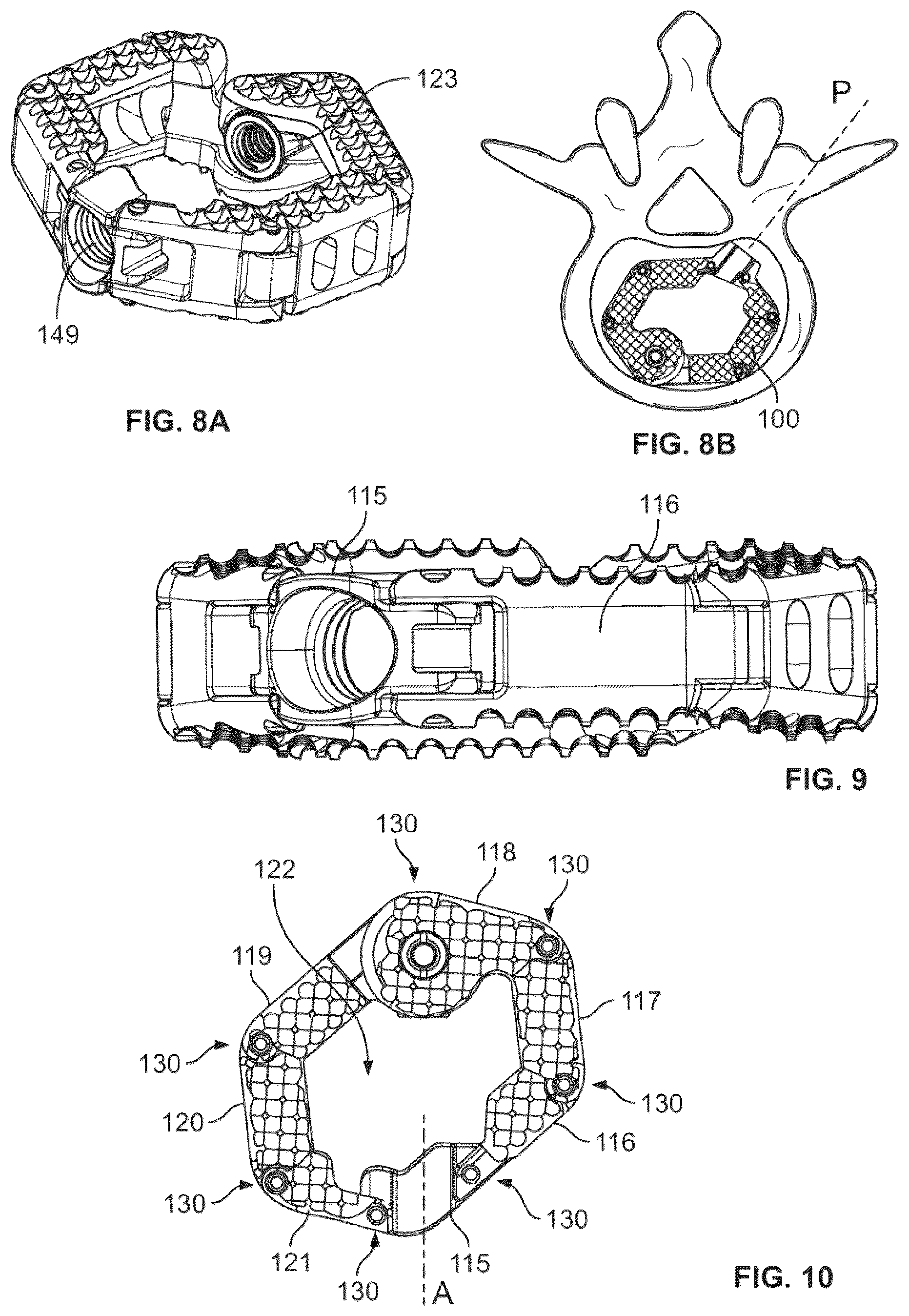 Patent US12310862 Figure 4 – Expandable spinal fusion implant, related instruments and methods