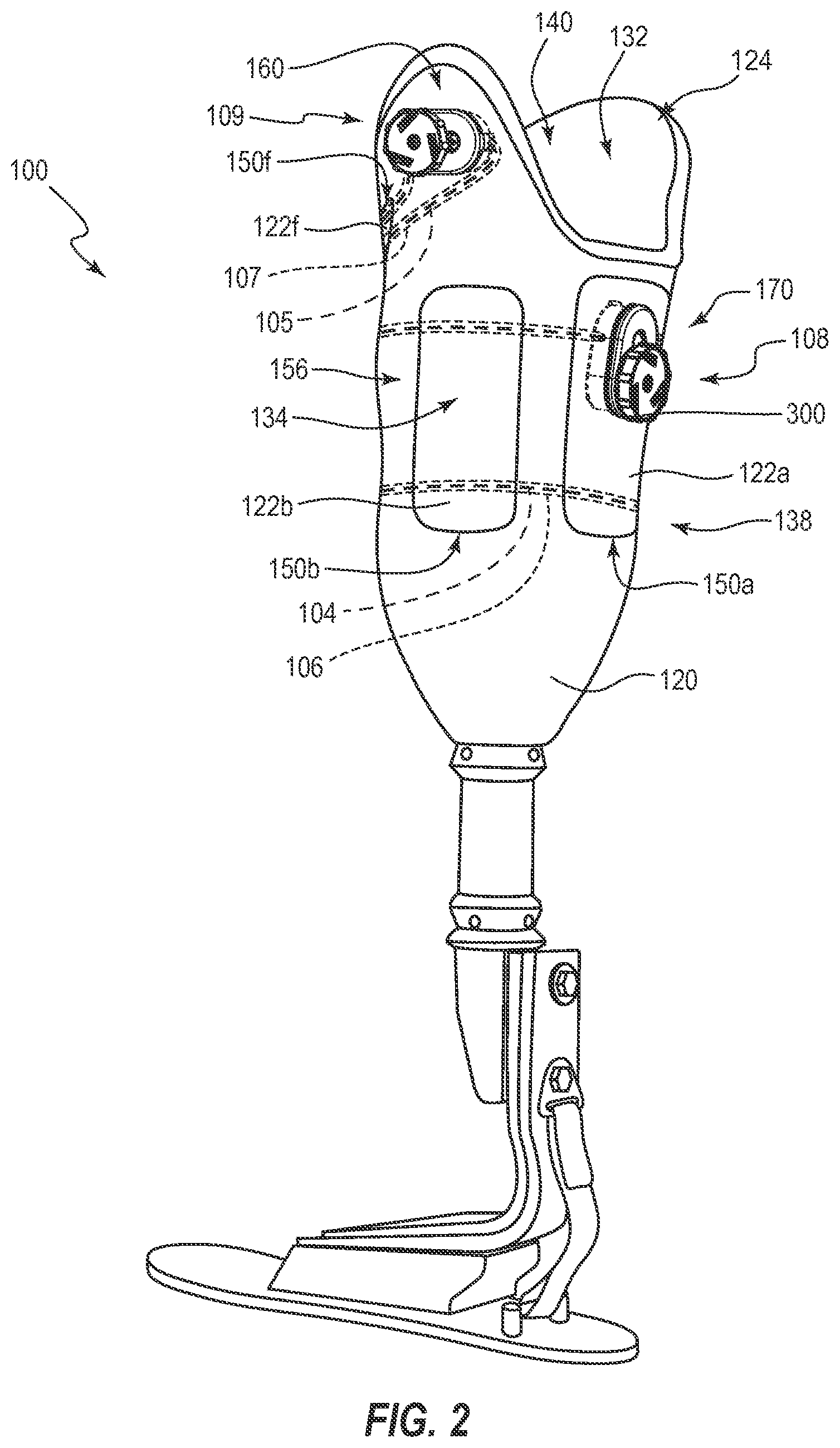Patent US12310864 Figure 2 – Adjustable prosthetic interfaces and related systems and methods