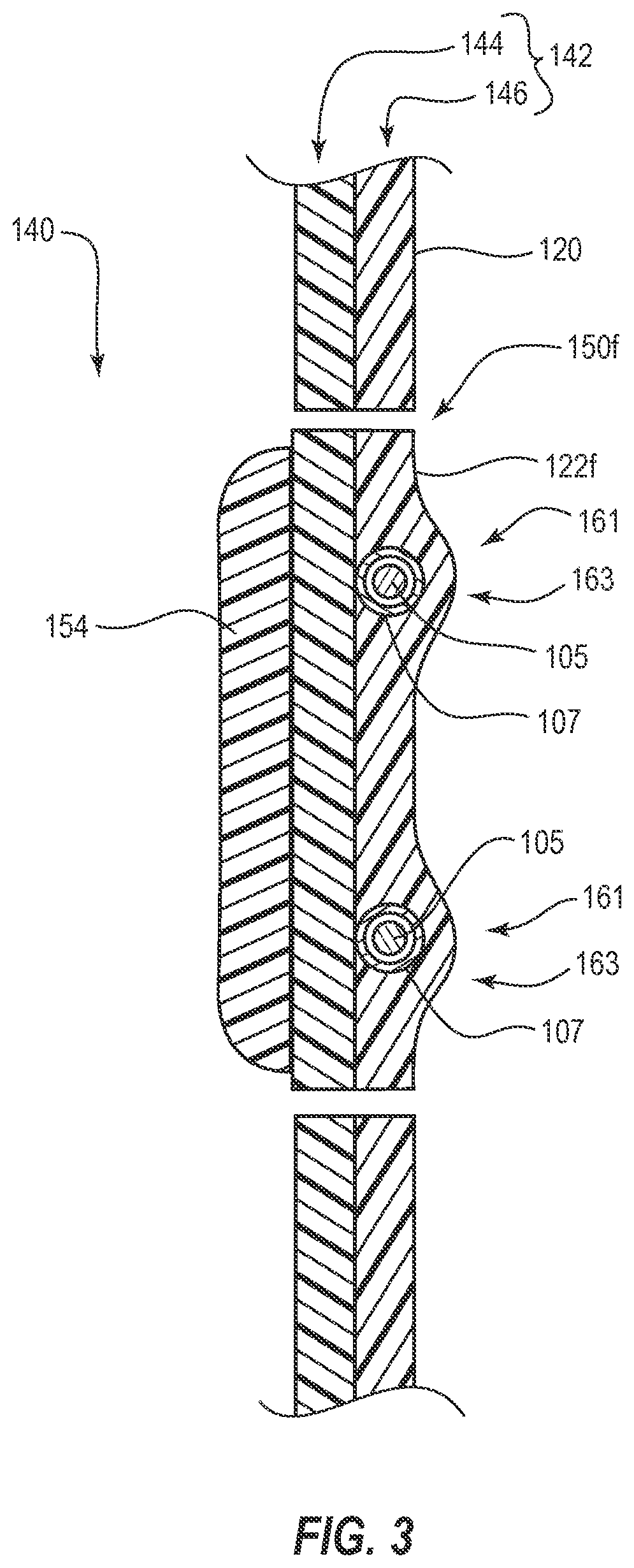 Patent US12310864 Figure 3 – Adjustable prosthetic interfaces and related systems and methods