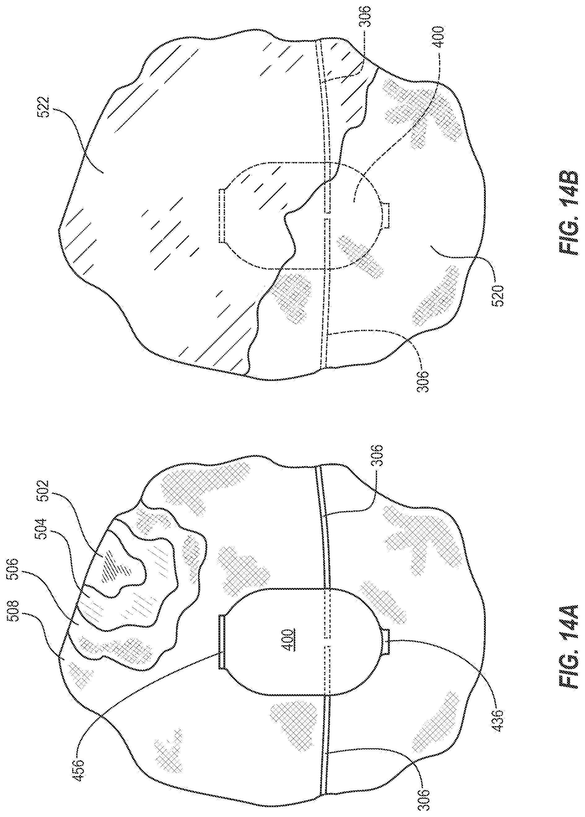 Patent US12310864 Figure 12 – Adjustable prosthetic interfaces and related systems and methods