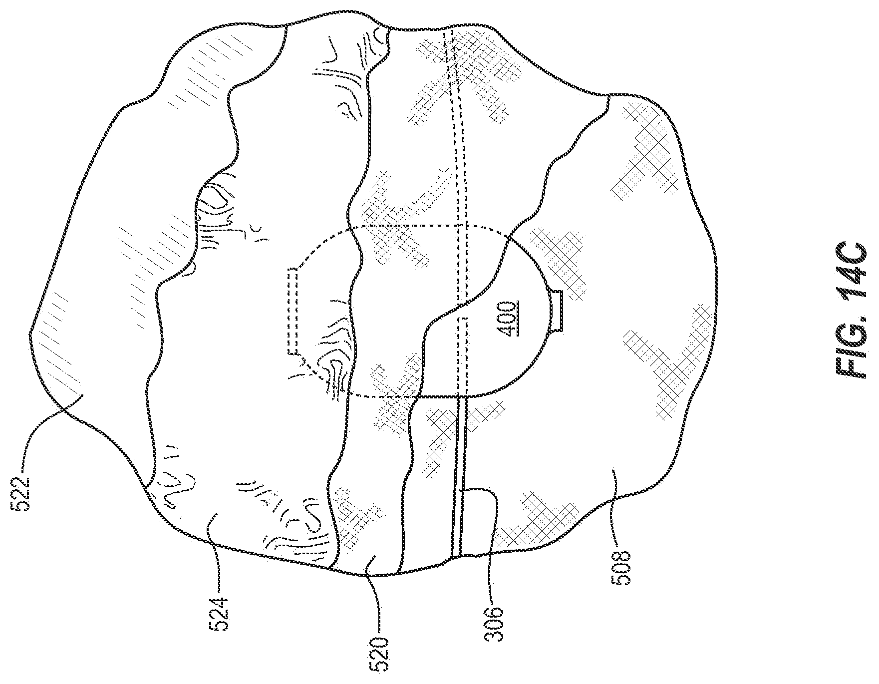 Patent US12310864 Figure 13 – Adjustable prosthetic interfaces and related systems and methods