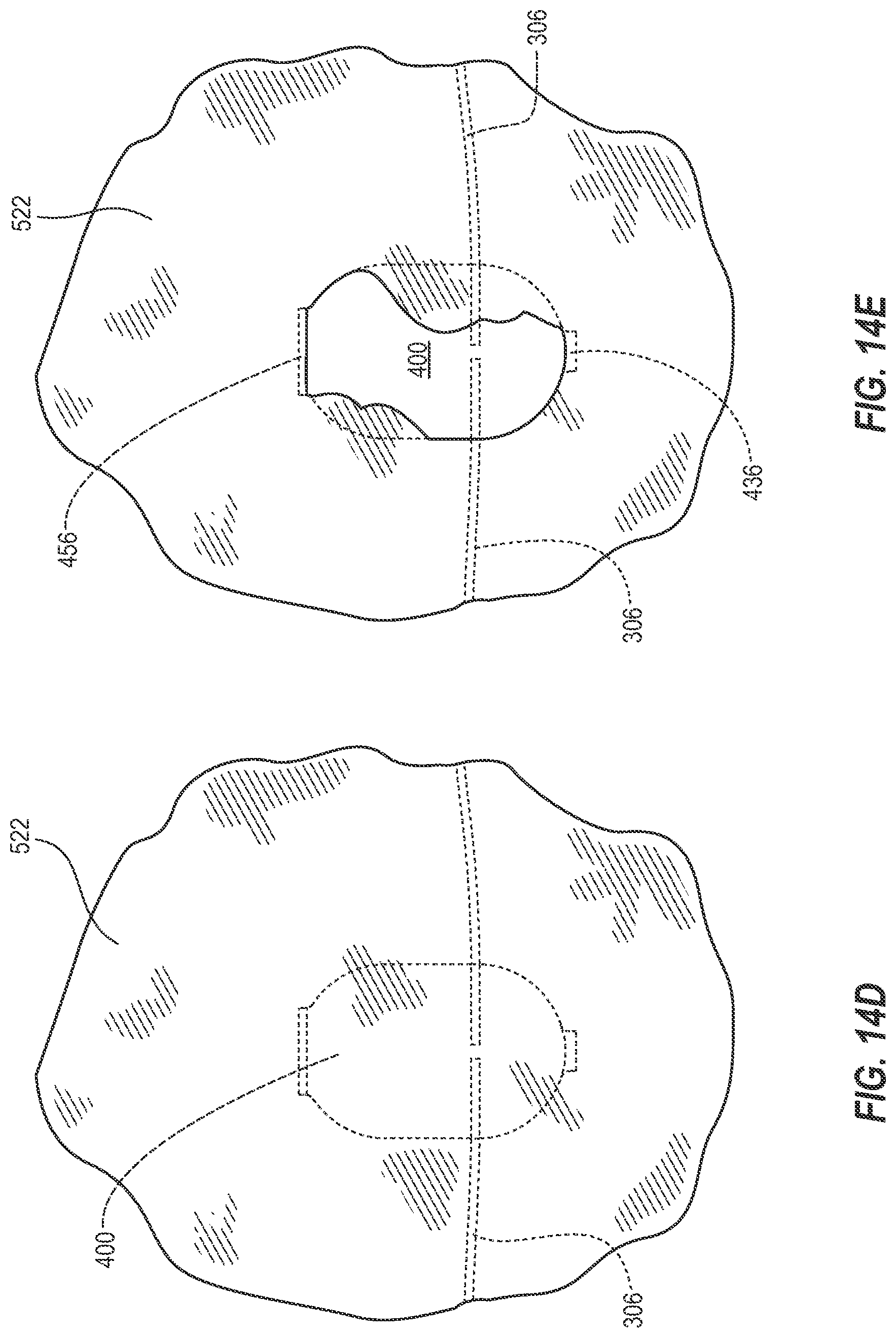 Patent US12310864 Figure 14 – Adjustable prosthetic interfaces and related systems and methods
