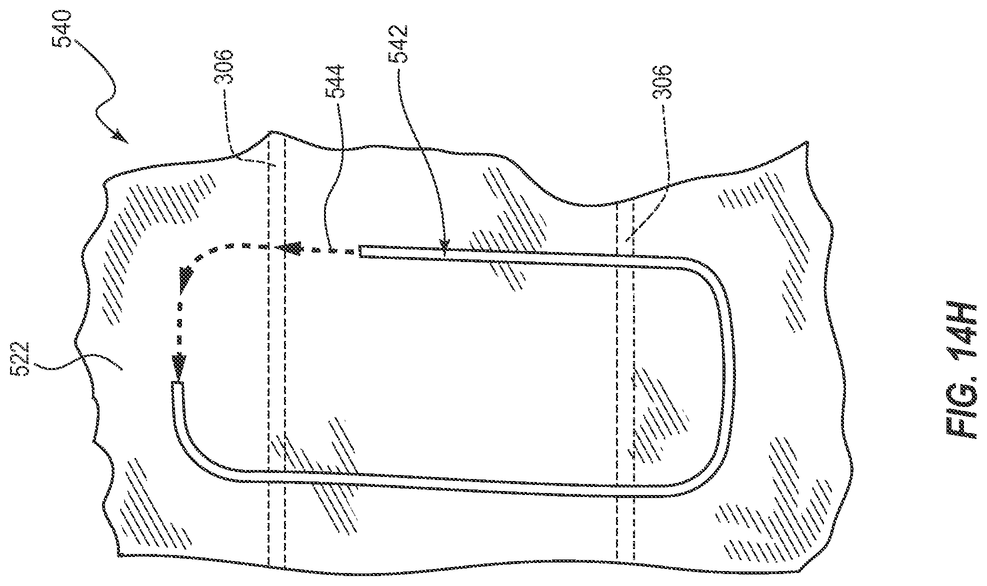 Patent US12310864 Figure 16 – Adjustable prosthetic interfaces and related systems and methods