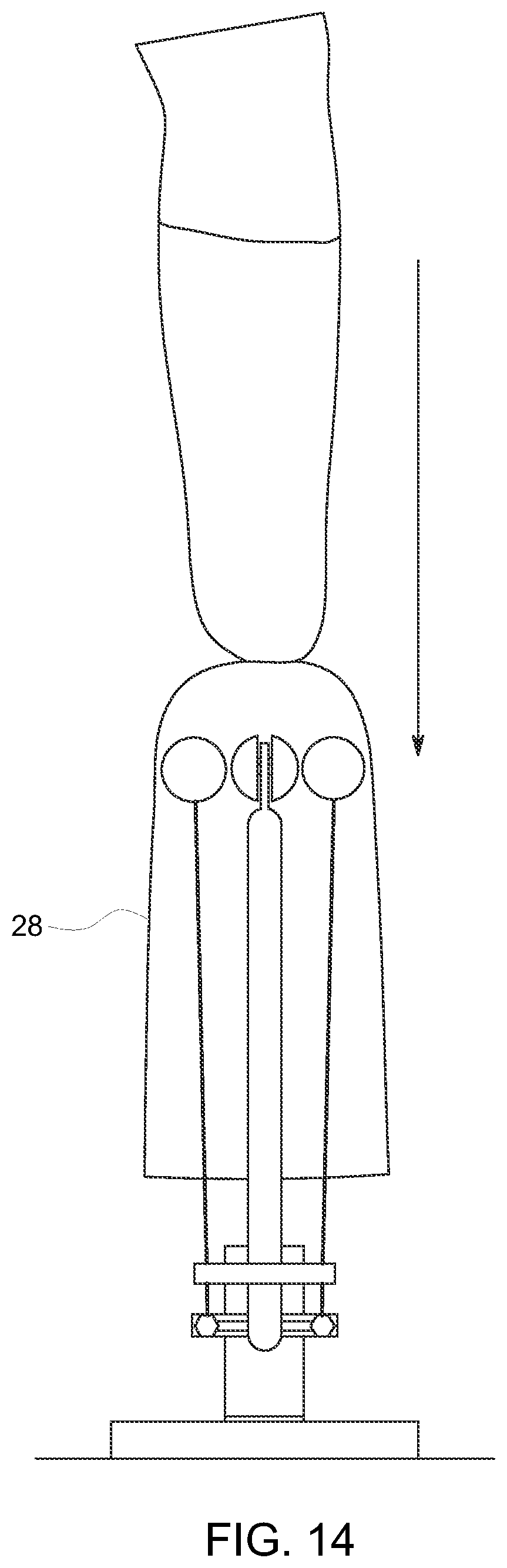 Patent US12310865 Figure 8 – Hands-free apparatus to apply a liner to an amputated appendage