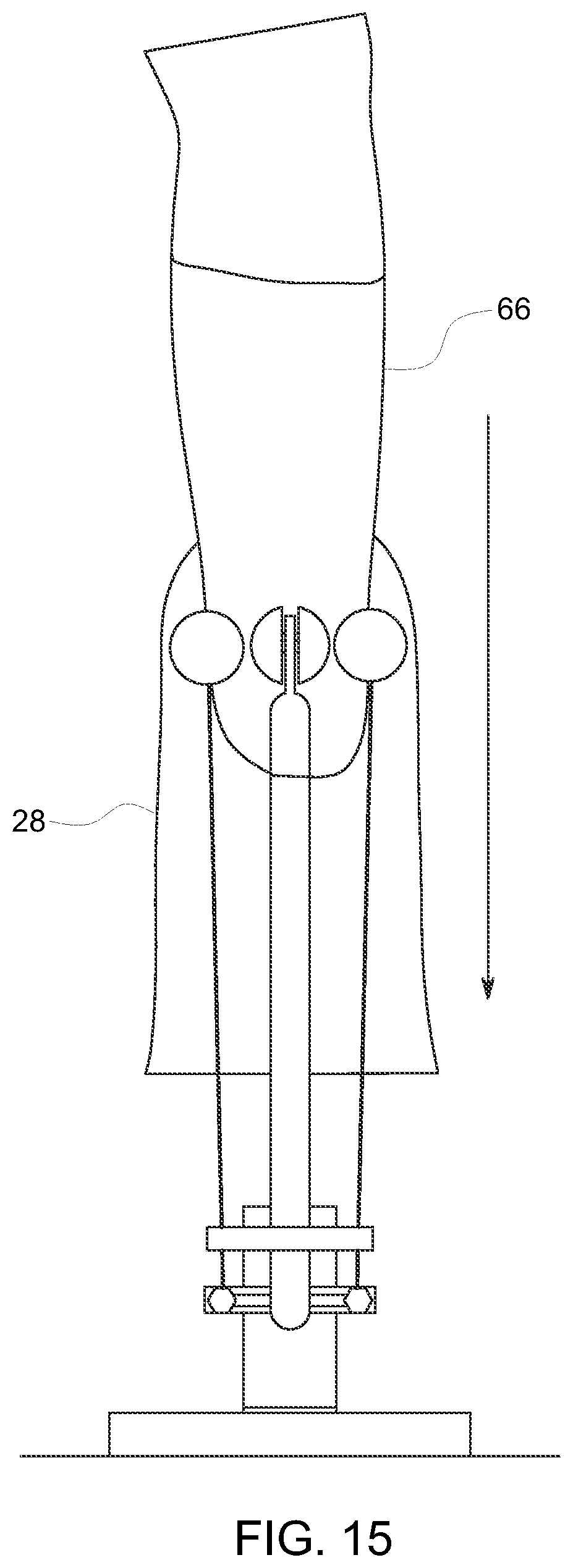 Patent US12310865 Figure 9 – Hands-free apparatus to apply a liner to an amputated appendage