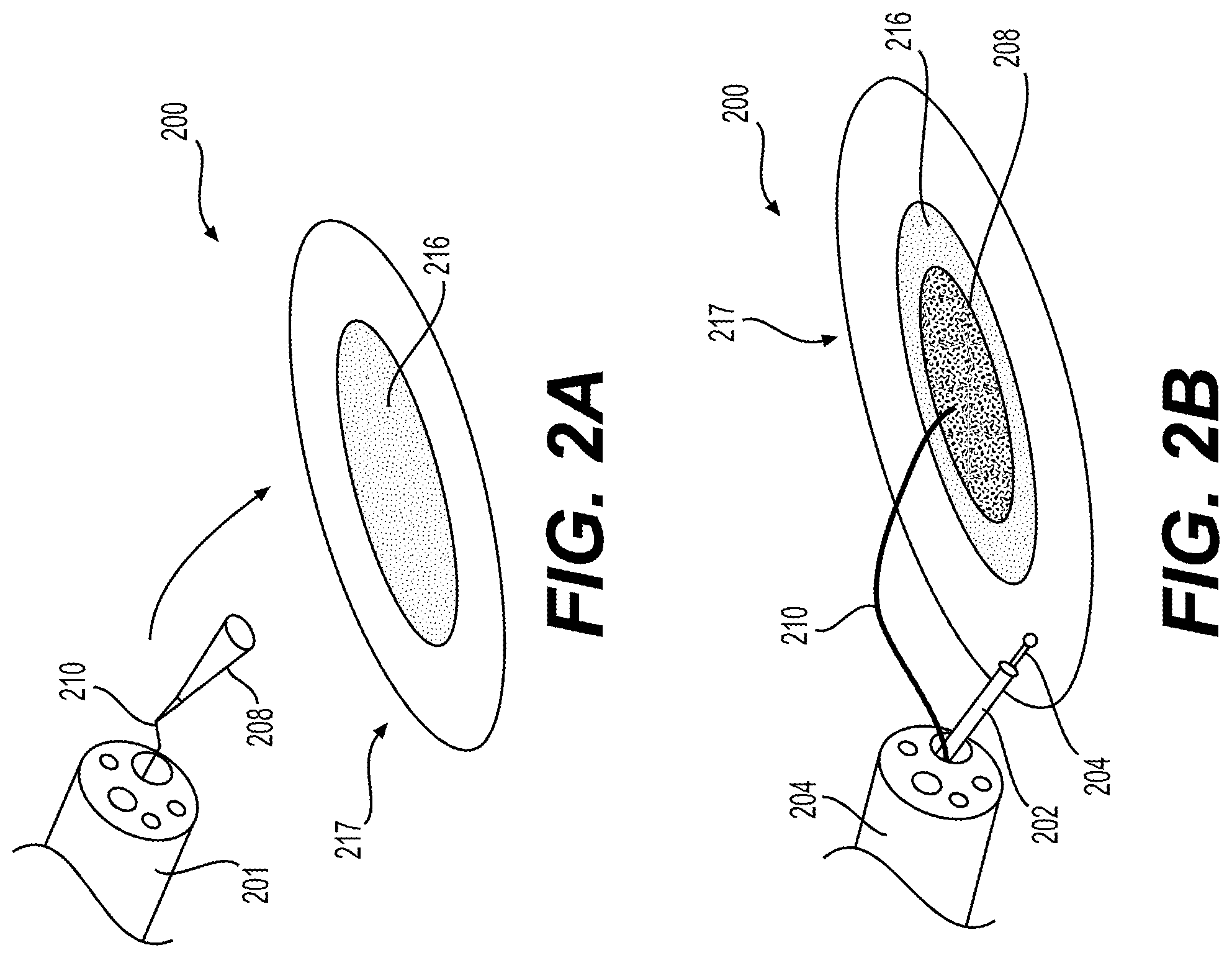 Patent US12310866 Figure 2 – Methods and devices for performing electrosurgery