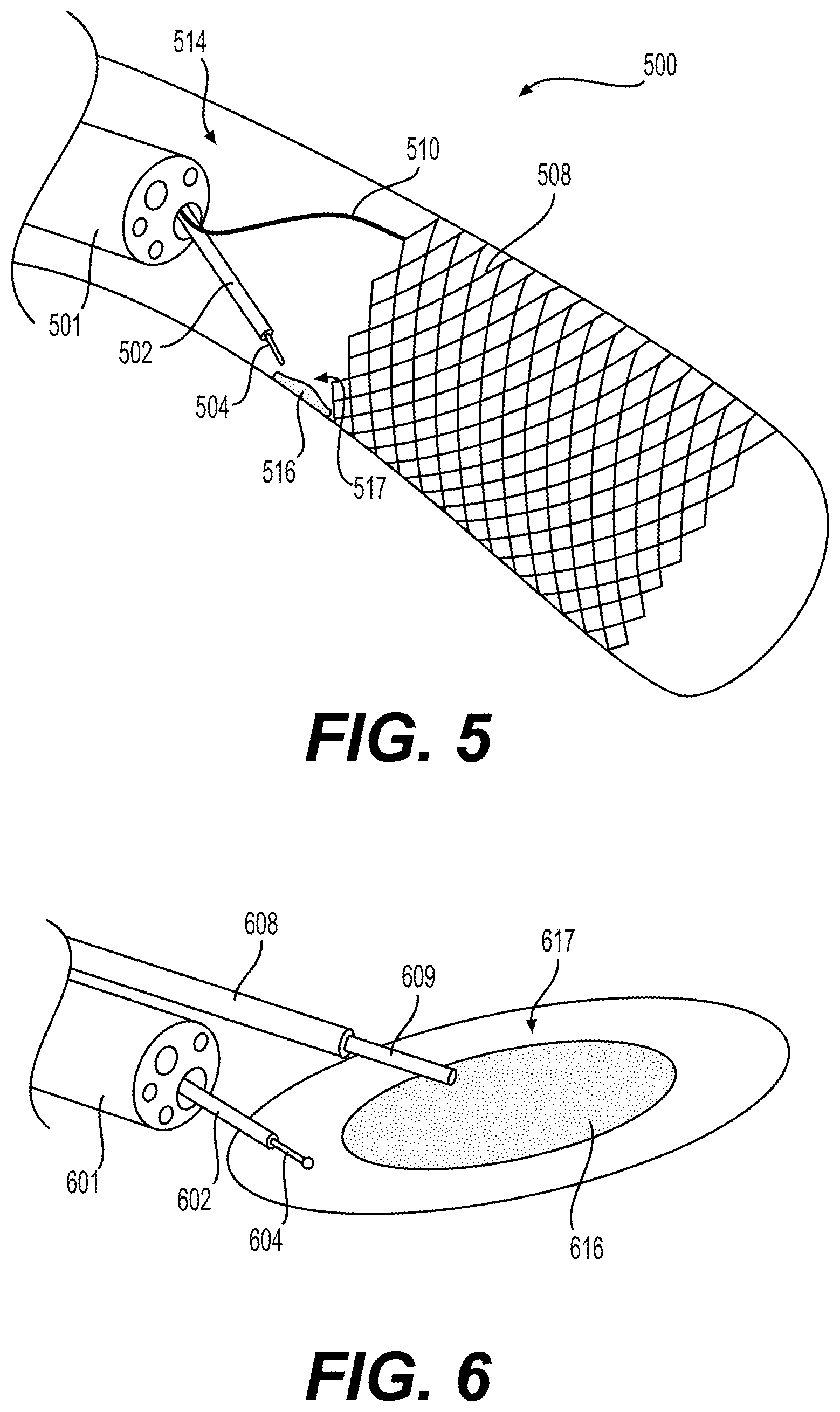 Patent US12310866 Figure 5 – Methods and devices for performing electrosurgery