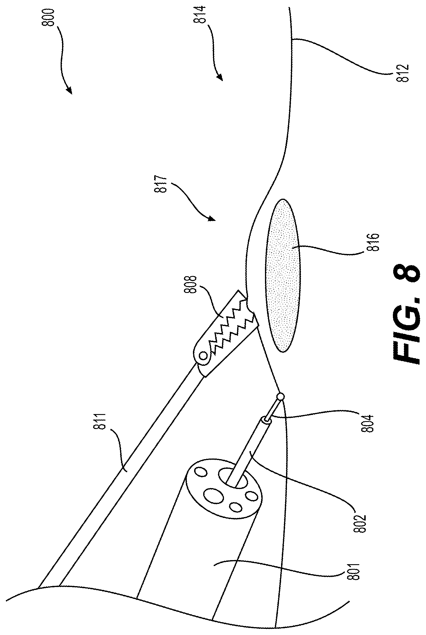 Patent US12310866 Figure 7 – Methods and devices for performing electrosurgery