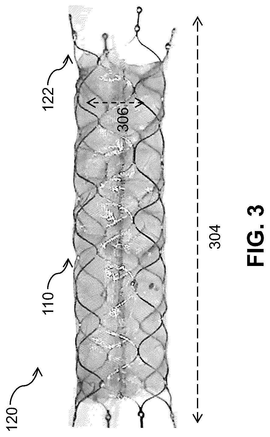 Patent US12310868 Figure 3 – Thin-film micromesh covers for medical devices and related methods