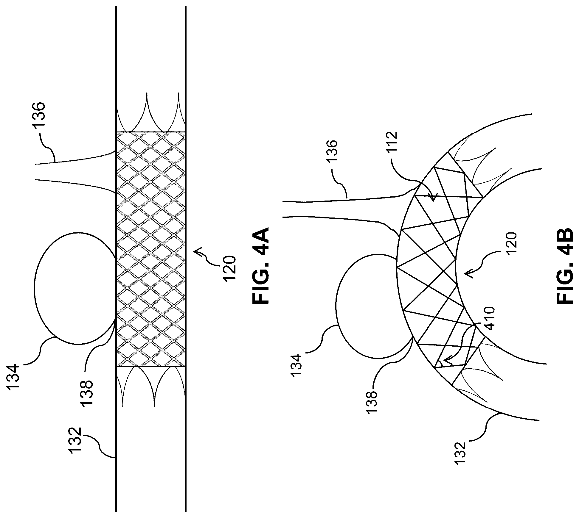 Patent US12310868 Figure 4 – Thin-film micromesh covers for medical devices and related methods