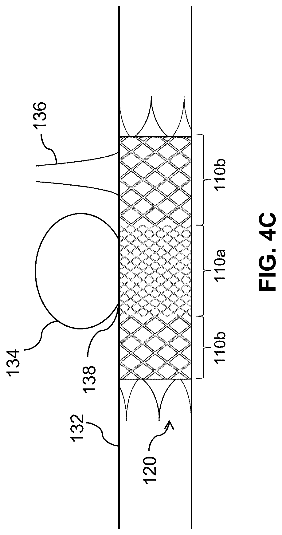 Patent US12310868 Figure 5 – Thin-film micromesh covers for medical devices and related methods