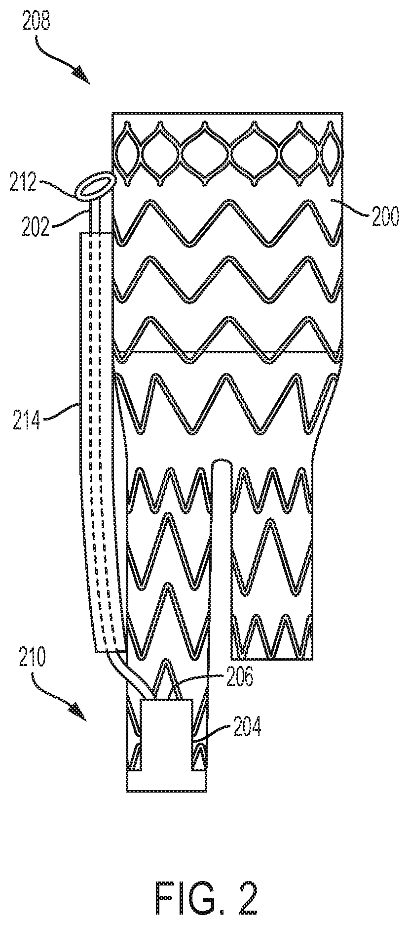 Patent US12310869 Figure 2 – Steering wire attach for angulation