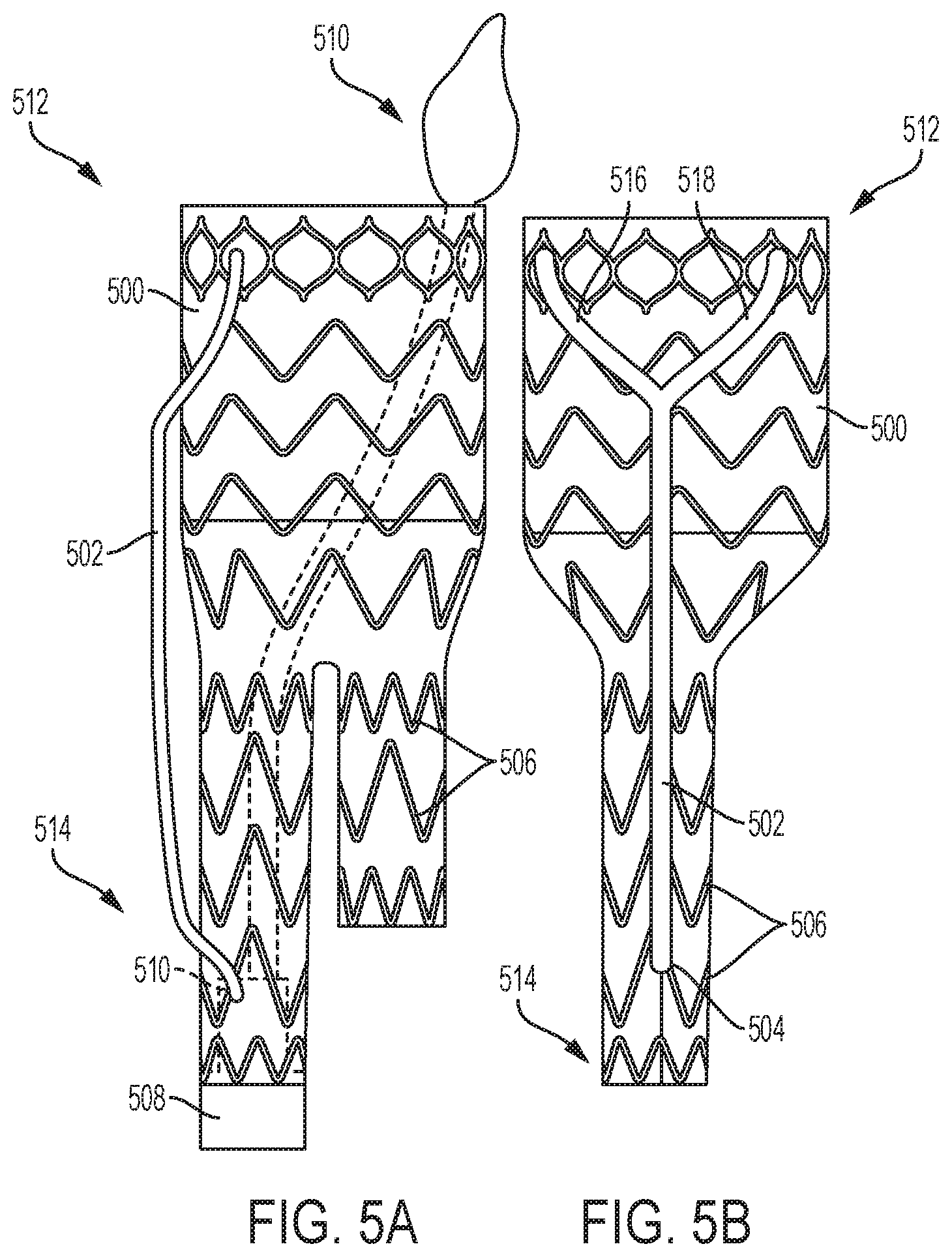 Patent US12310869 Figure 5 – Steering wire attach for angulation