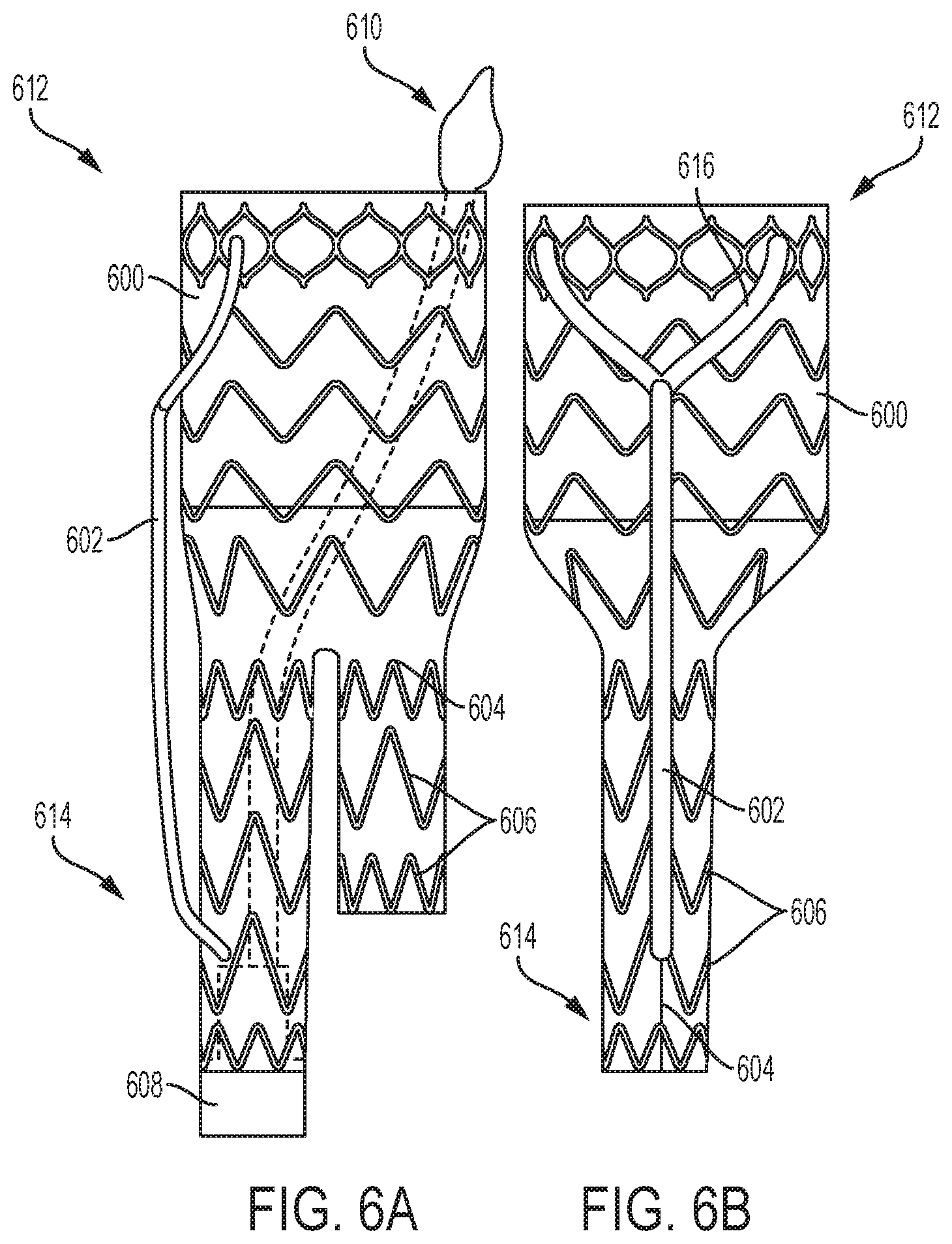 Patent US12310869 Figure 6 – Steering wire attach for angulation