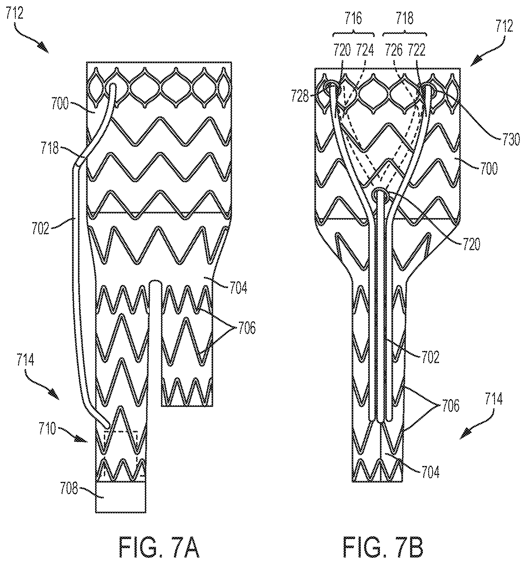Patent US12310869 Figure 7 – Steering wire attach for angulation