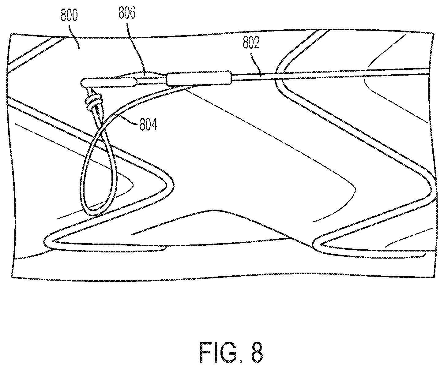 Patent US12310869 Figure 8 – Steering wire attach for angulation