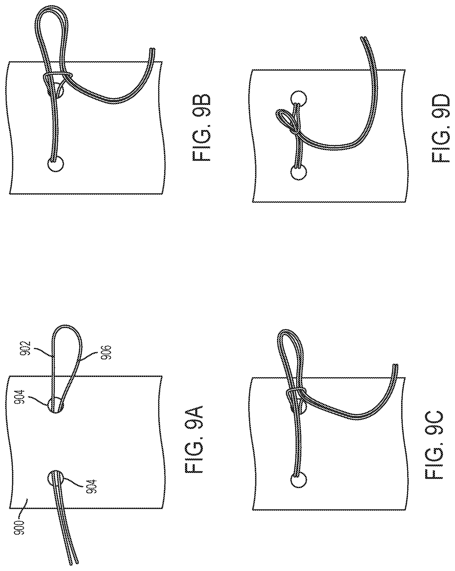 Patent US12310869 Figure 9 – Steering wire attach for angulation