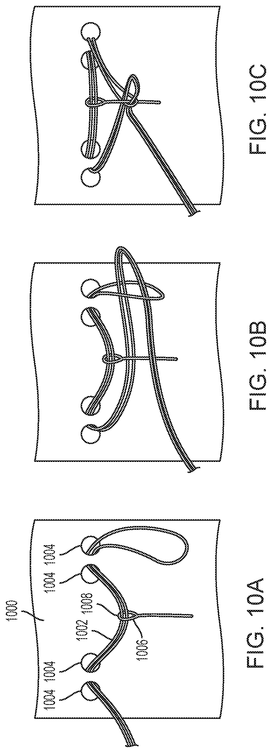 Patent US12310869 Figure 10 – Steering wire attach for angulation