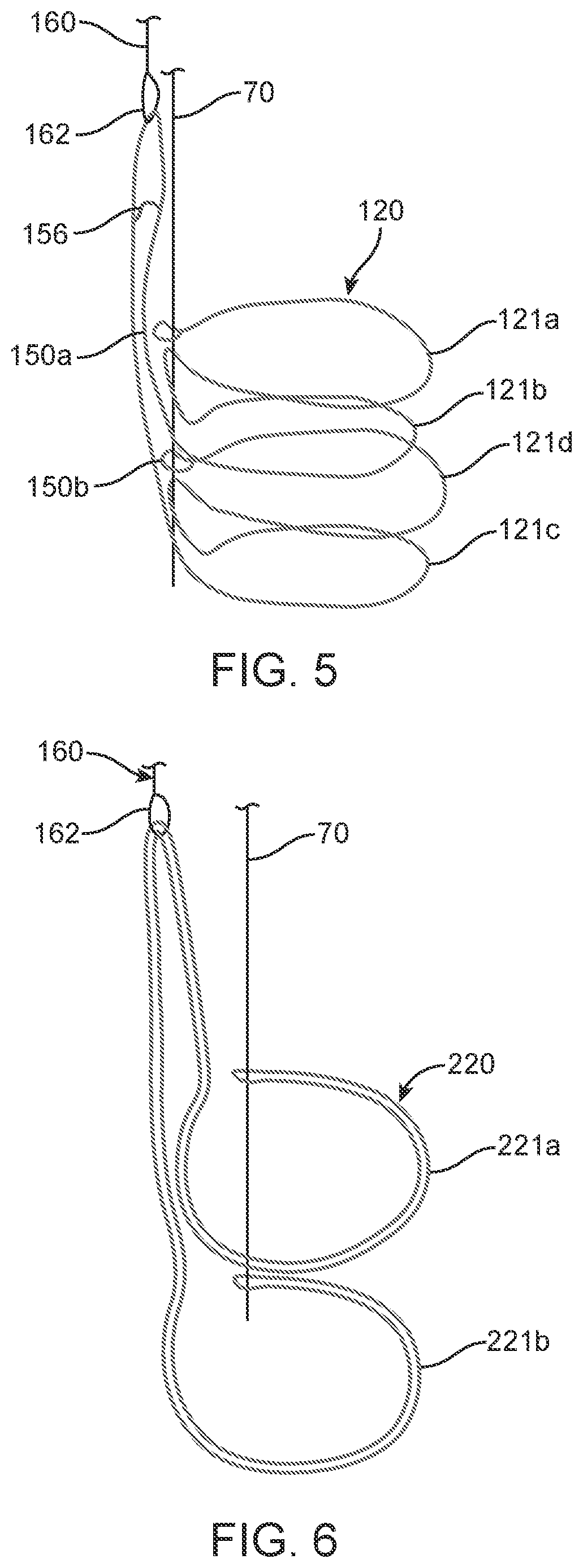 Patent US12310870 Figure 3 – Tension member routing designs to achieve transcatheter stented prosthesis compression