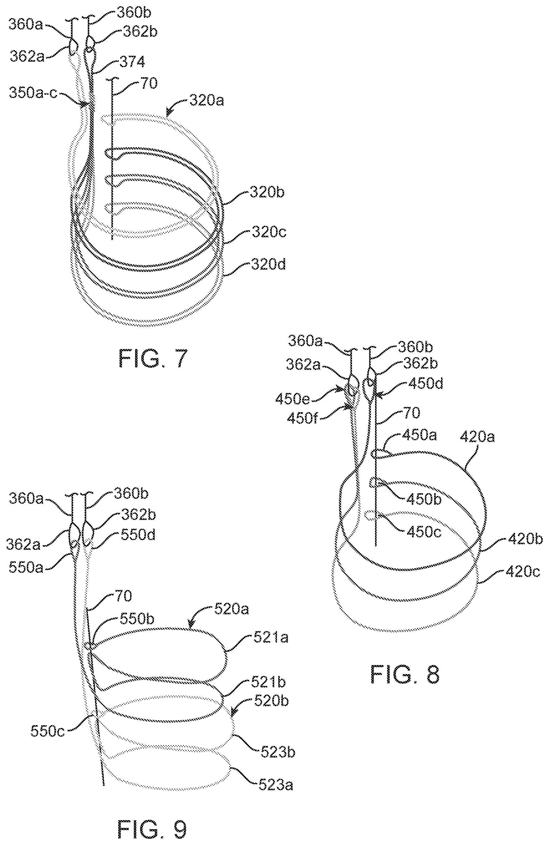 Patent US12310870 Figure 4 – Tension member routing designs to achieve transcatheter stented prosthesis compression