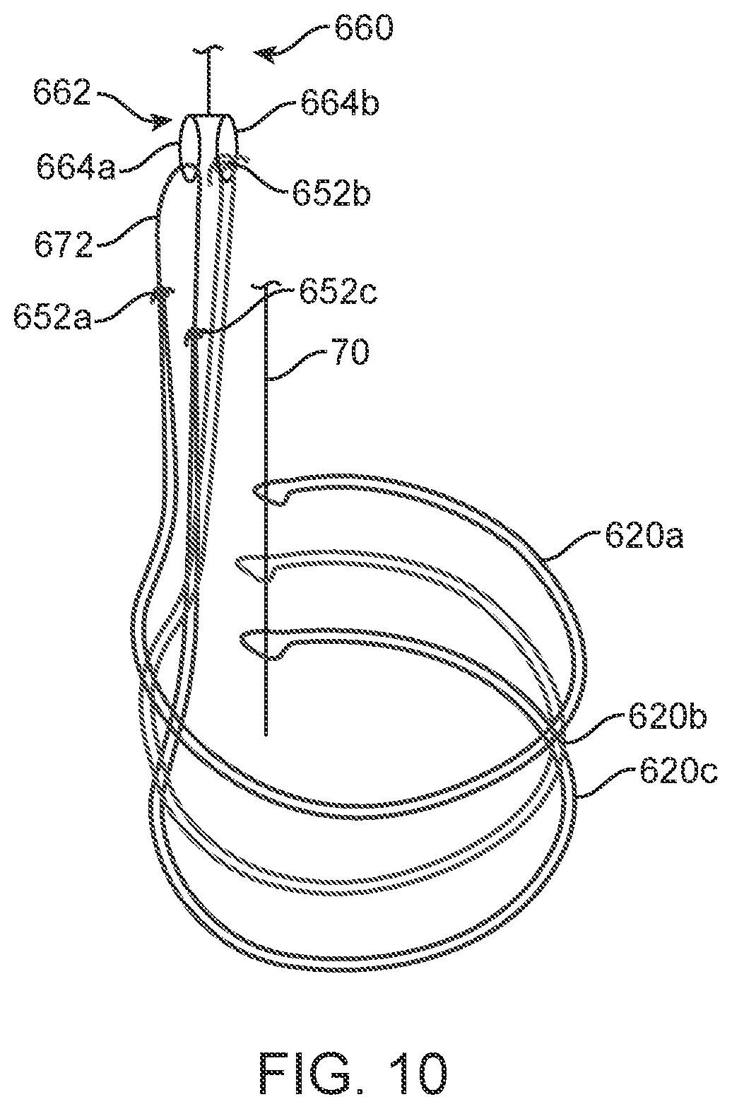 Patent US12310870 Figure 5 – Tension member routing designs to achieve transcatheter stented prosthesis compression