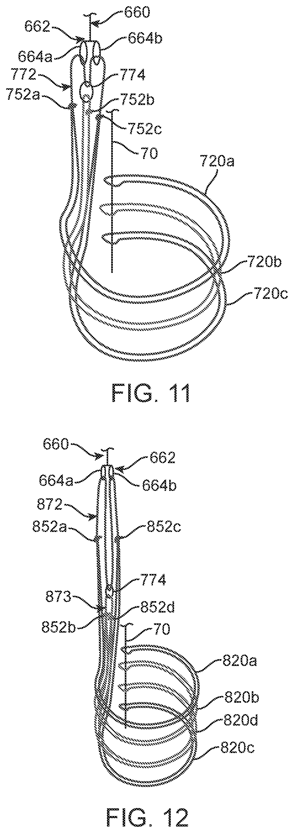 Patent US12310870 Figure 6 – Tension member routing designs to achieve transcatheter stented prosthesis compression