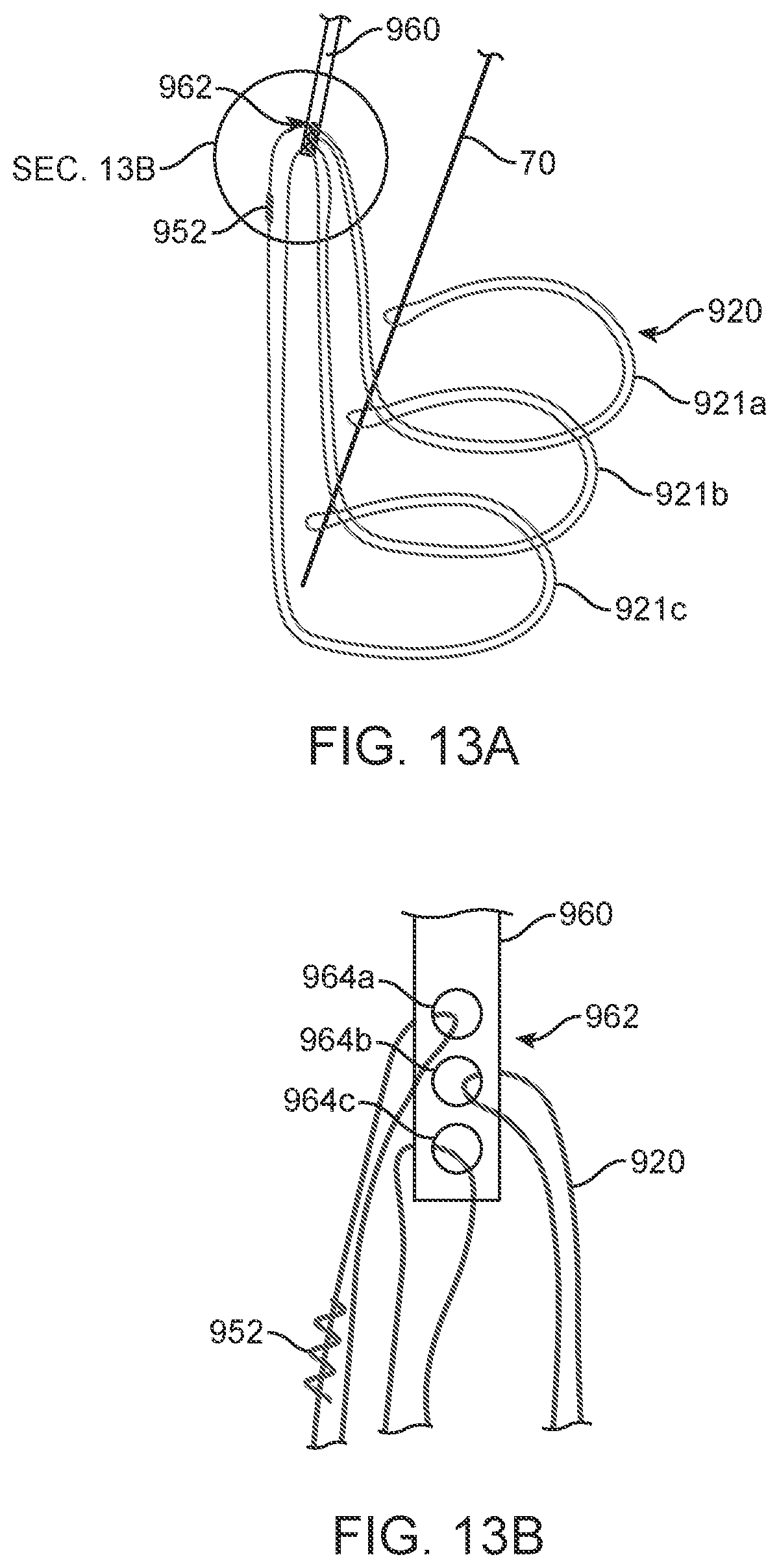Patent US12310870 Figure 7 – Tension member routing designs to achieve transcatheter stented prosthesis compression
