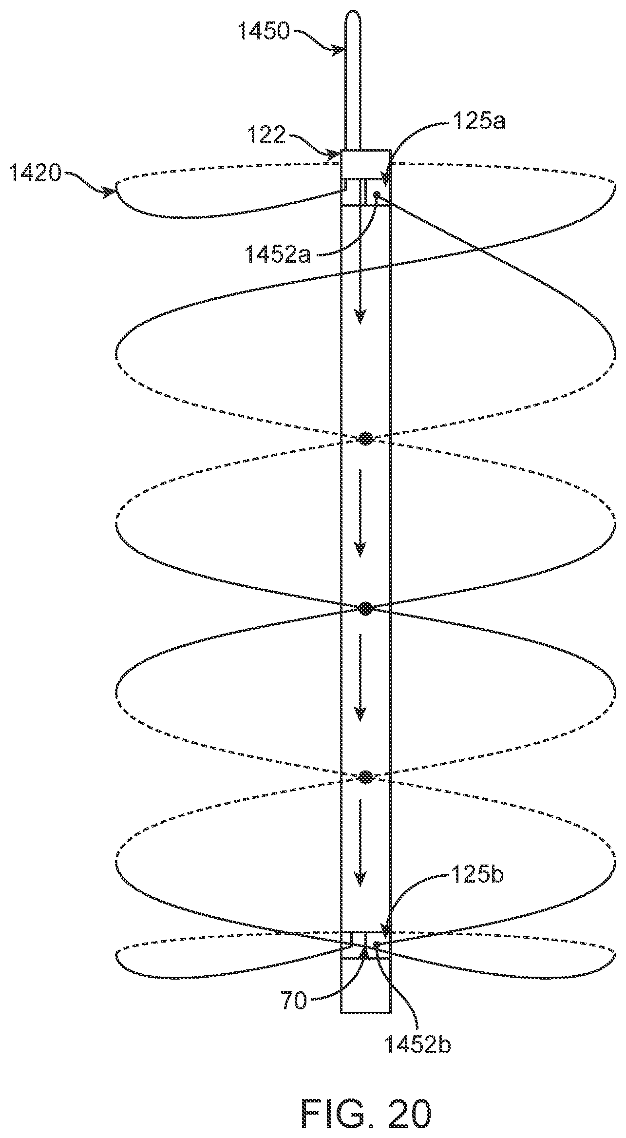 Patent US12310870 Figure 11 – Tension member routing designs to achieve transcatheter stented prosthesis compression