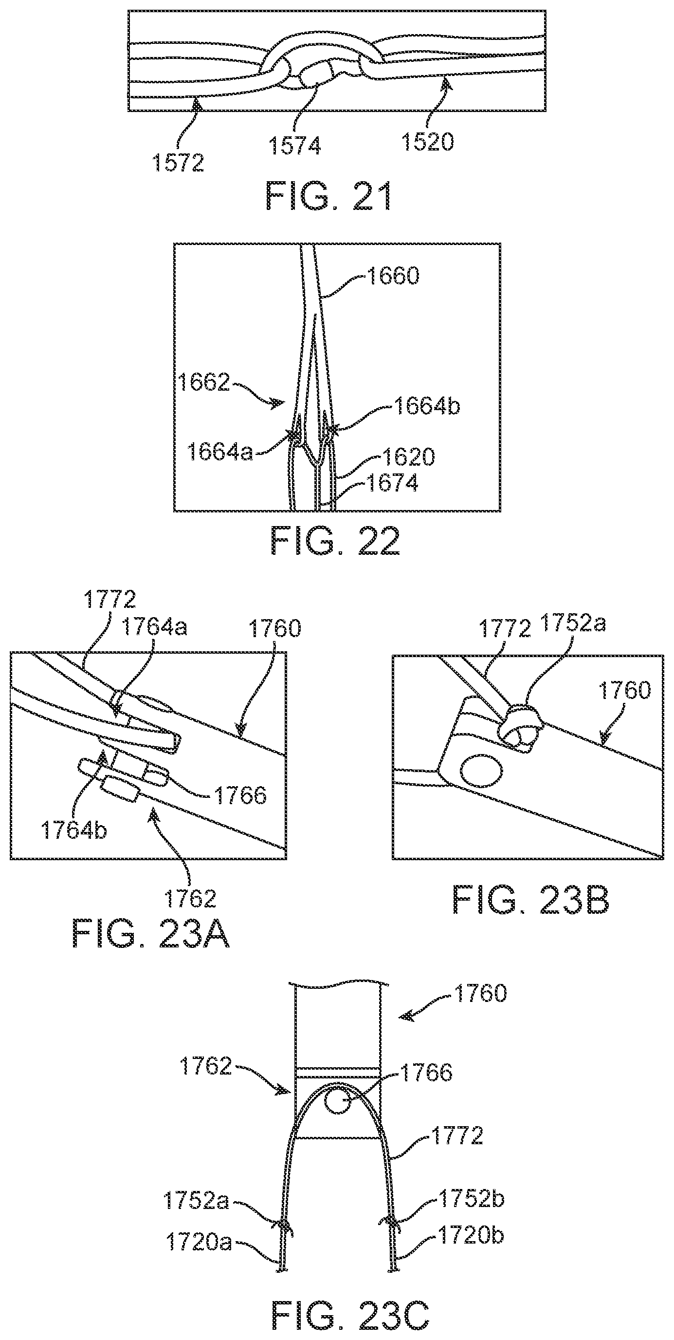 Patent US12310870 Figure 12 – Tension member routing designs to achieve transcatheter stented prosthesis compression