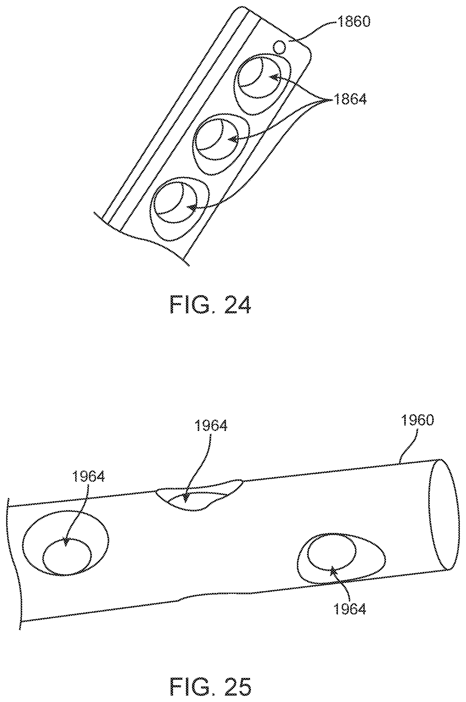 Patent US12310870 Figure 13 – Tension member routing designs to achieve transcatheter stented prosthesis compression