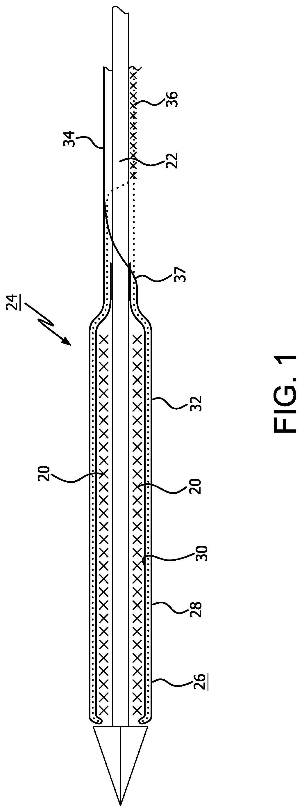 Patent US12310871 Figure 1 – Implantable medical device constraint and deployment apparatus