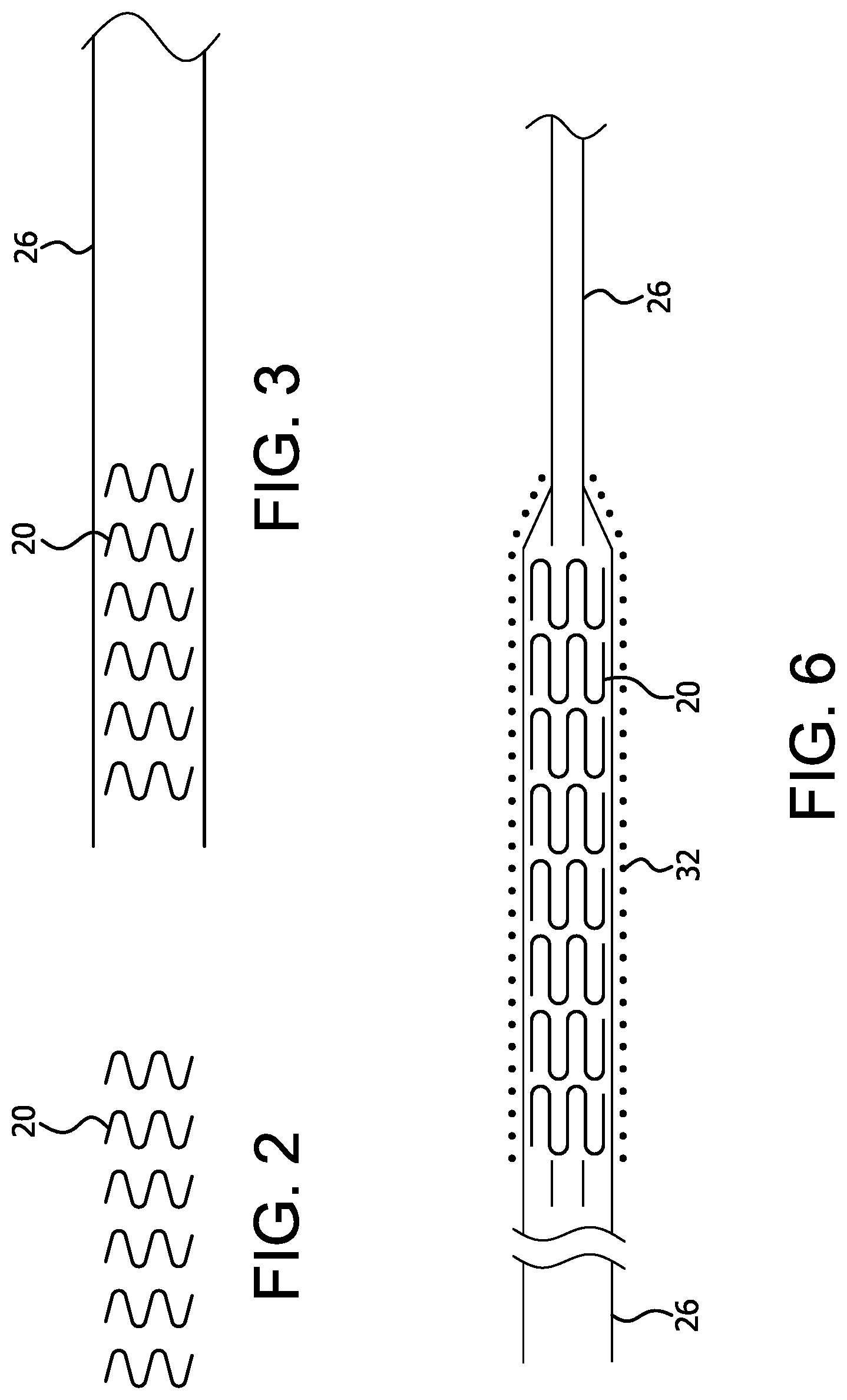 Patent US12310871 Figure 2 – Implantable medical device constraint and deployment apparatus