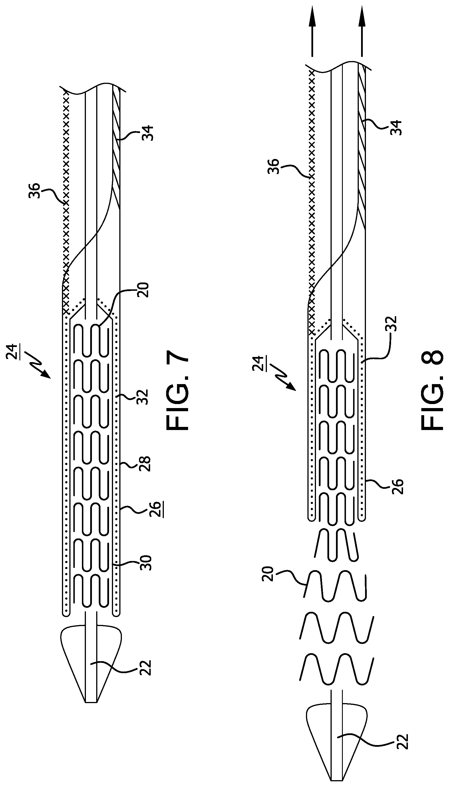 Patent US12310871 Figure 4 – Implantable medical device constraint and deployment apparatus