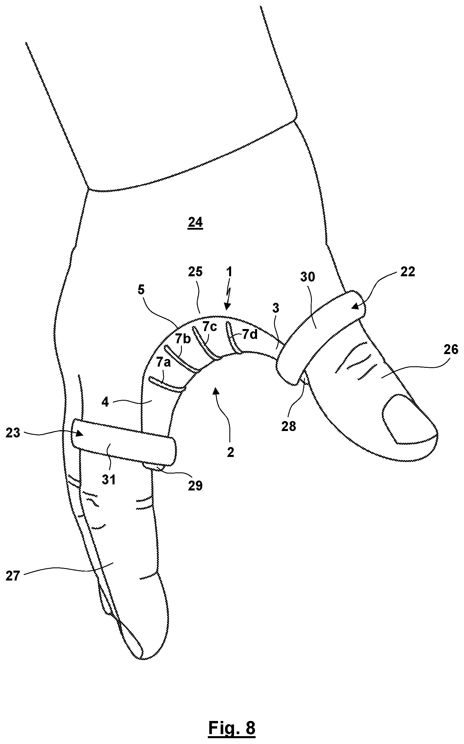 Patent US12310872 Figure 5 – Thumb orthosis and set of a plurality of thumb orthoses