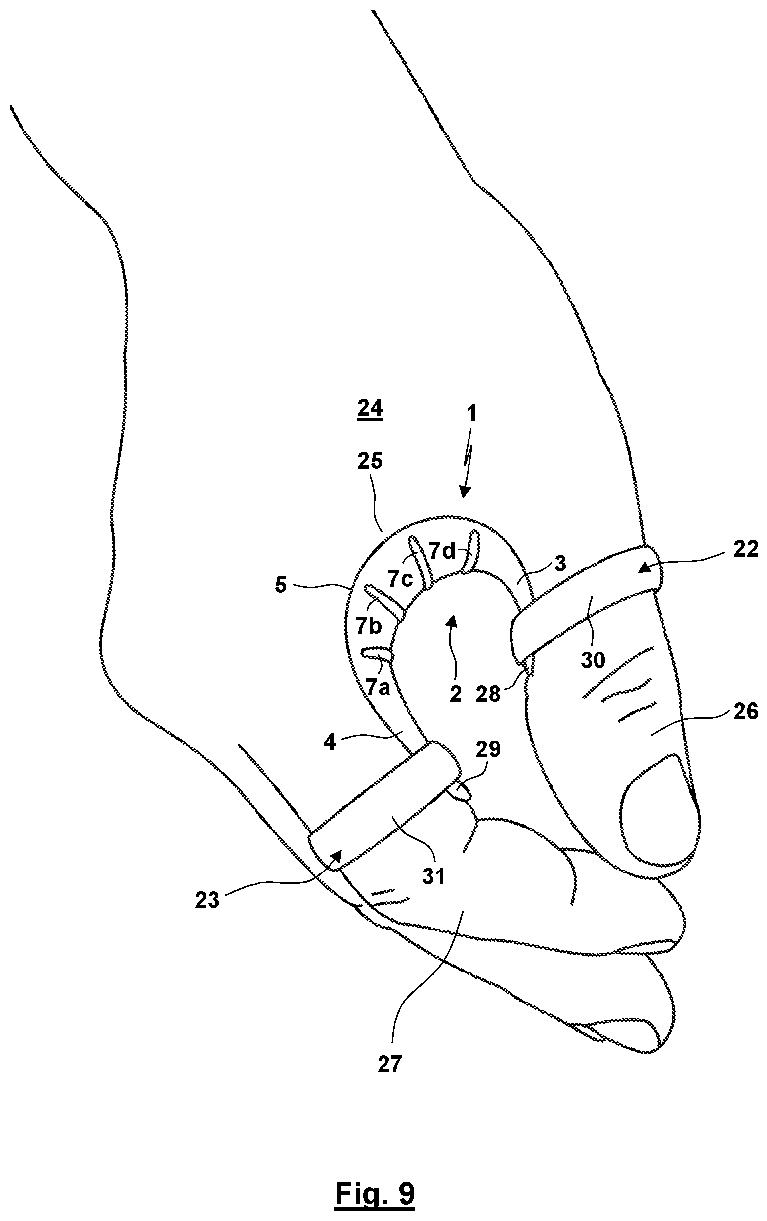 Patent US12310872 Figure 6 – Thumb orthosis and set of a plurality of thumb orthoses