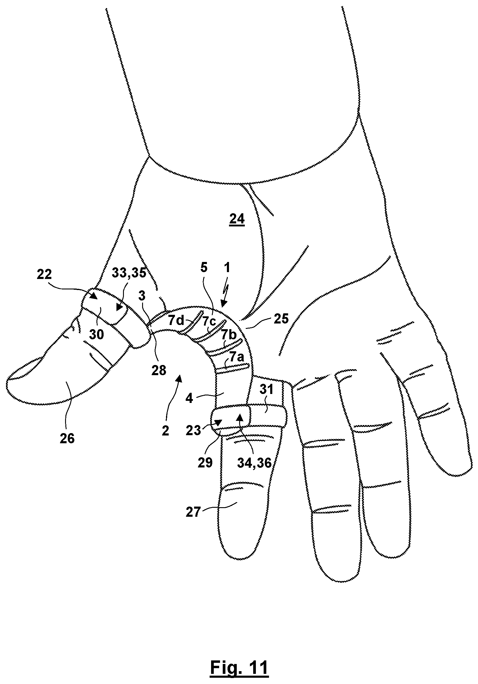 Patent US12310872 Figure 8 – Thumb orthosis and set of a plurality of thumb orthoses