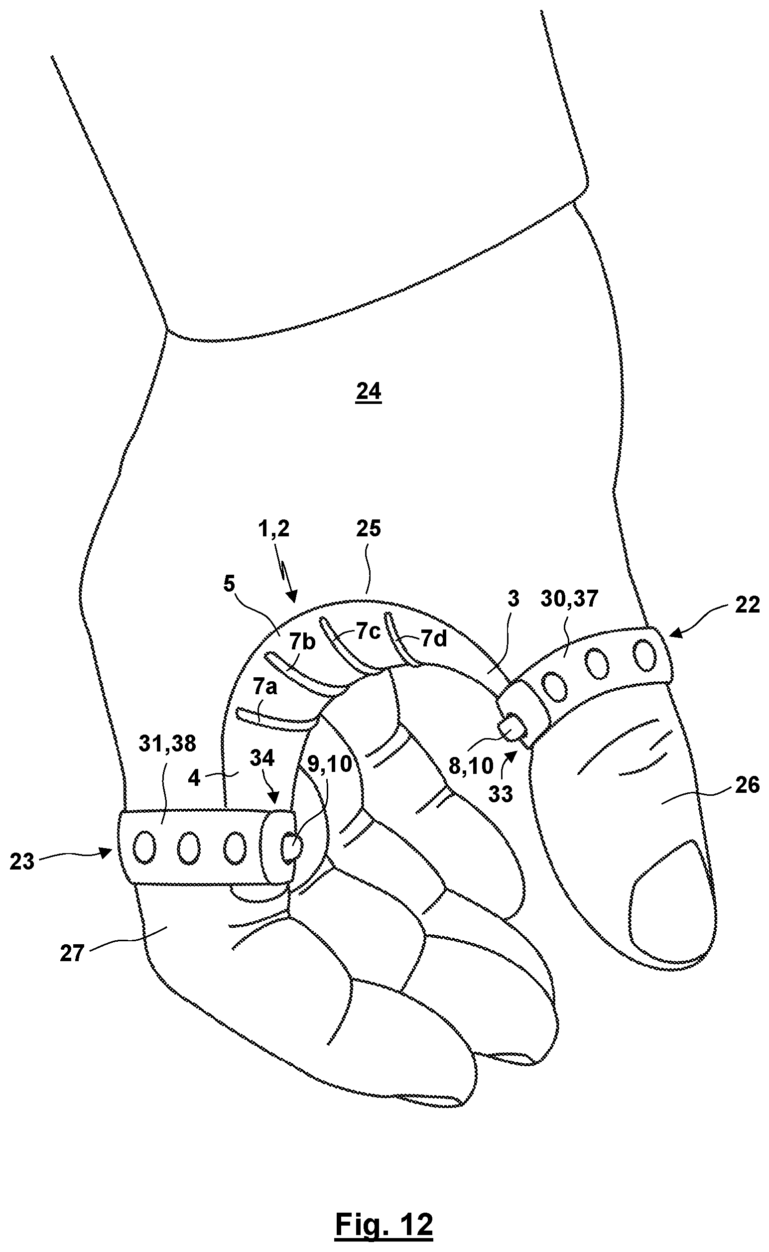 Patent US12310872 Figure 9 – Thumb orthosis and set of a plurality of thumb orthoses