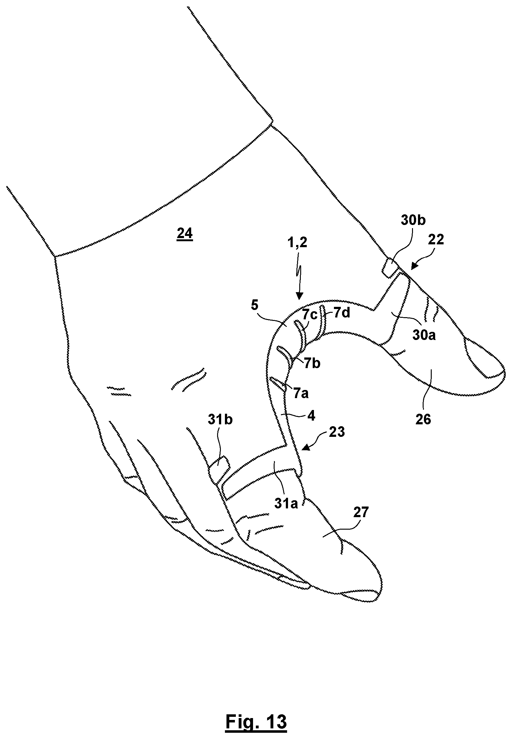 Patent US12310872 Figure 10 – Thumb orthosis and set of a plurality of thumb orthoses